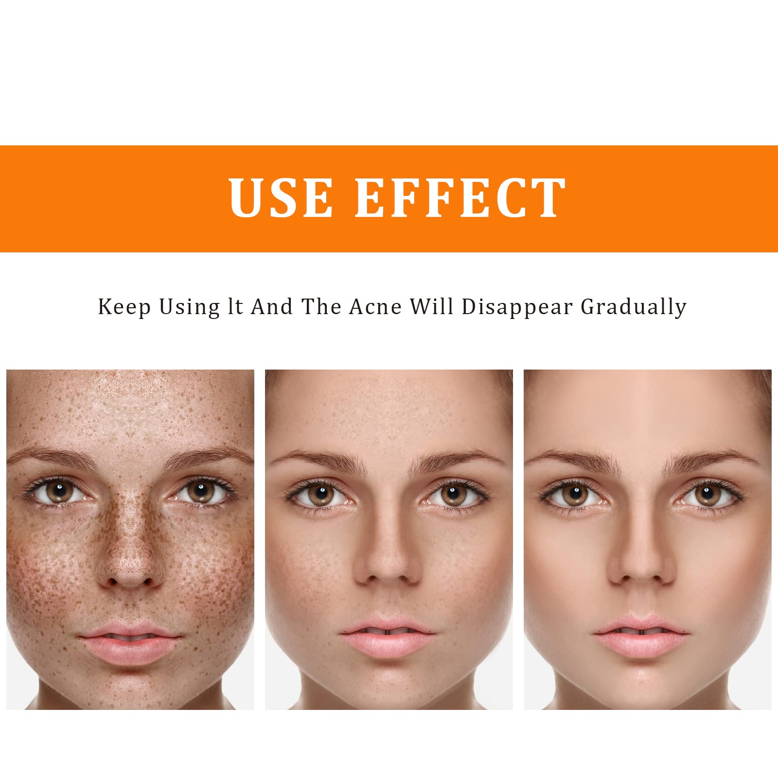 Toner For Dark Spots Turmeric Dark Spot Corrector Toner, Facial Toner For Acne Prone Skin, Dark Spot Remover For Face Hydrating