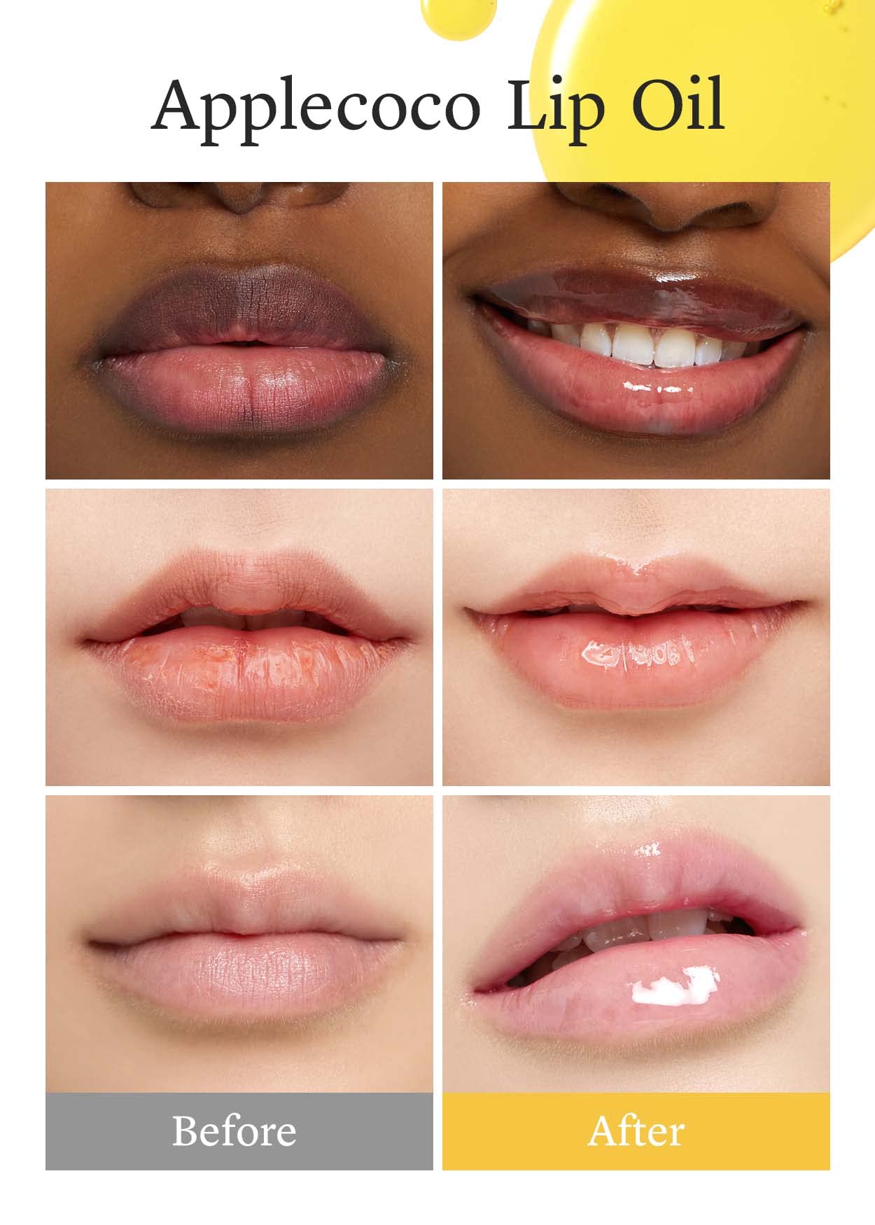 Nooni Korean Lip Oil - Applecoco | Lip Stain, Gift, Long-Lasting, Moisturizing, Plumping, Revitalizing For Dry Lips, Waterproof,