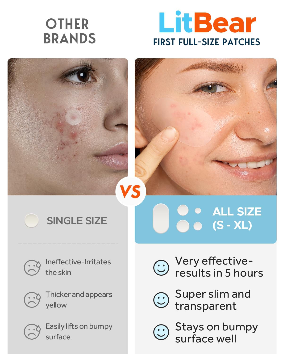 LitBear Large Pimple Patches - 80 Pieces, Reduces Inflammation, with Tea Tree & Calendula Oil, Transparent
