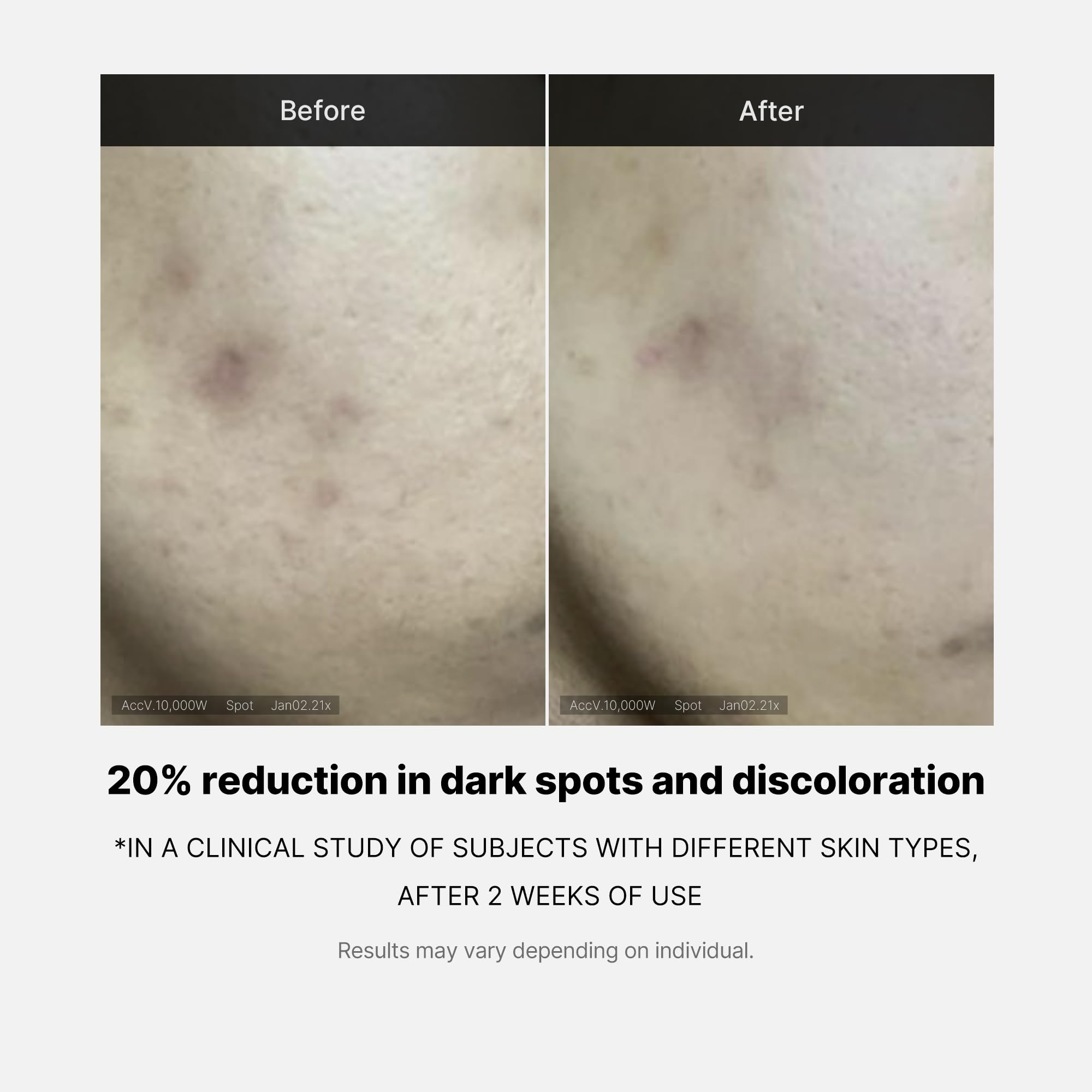 Medicube Deep Vita C Serum 2.0 || 14.5% Pure Vitamin C Reduce The Appearance Of Hyperpigmentation, Dark Spots, And Blemishes | 1