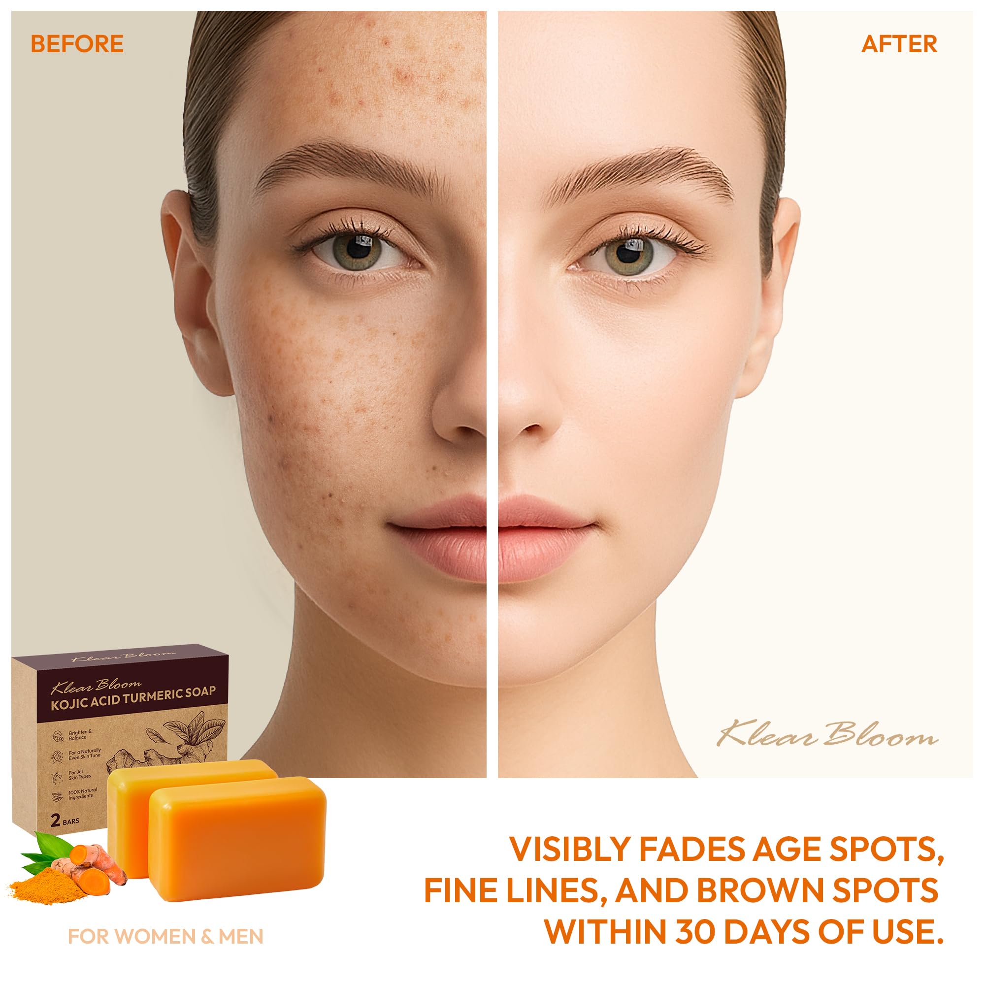 KlearBloom Kojic Acid Soap, Turmeric Soap Bar for Dark Spots with Collagen, Vitamin E, Retinol, Hyaluronic Acid, Shea Butter - 1