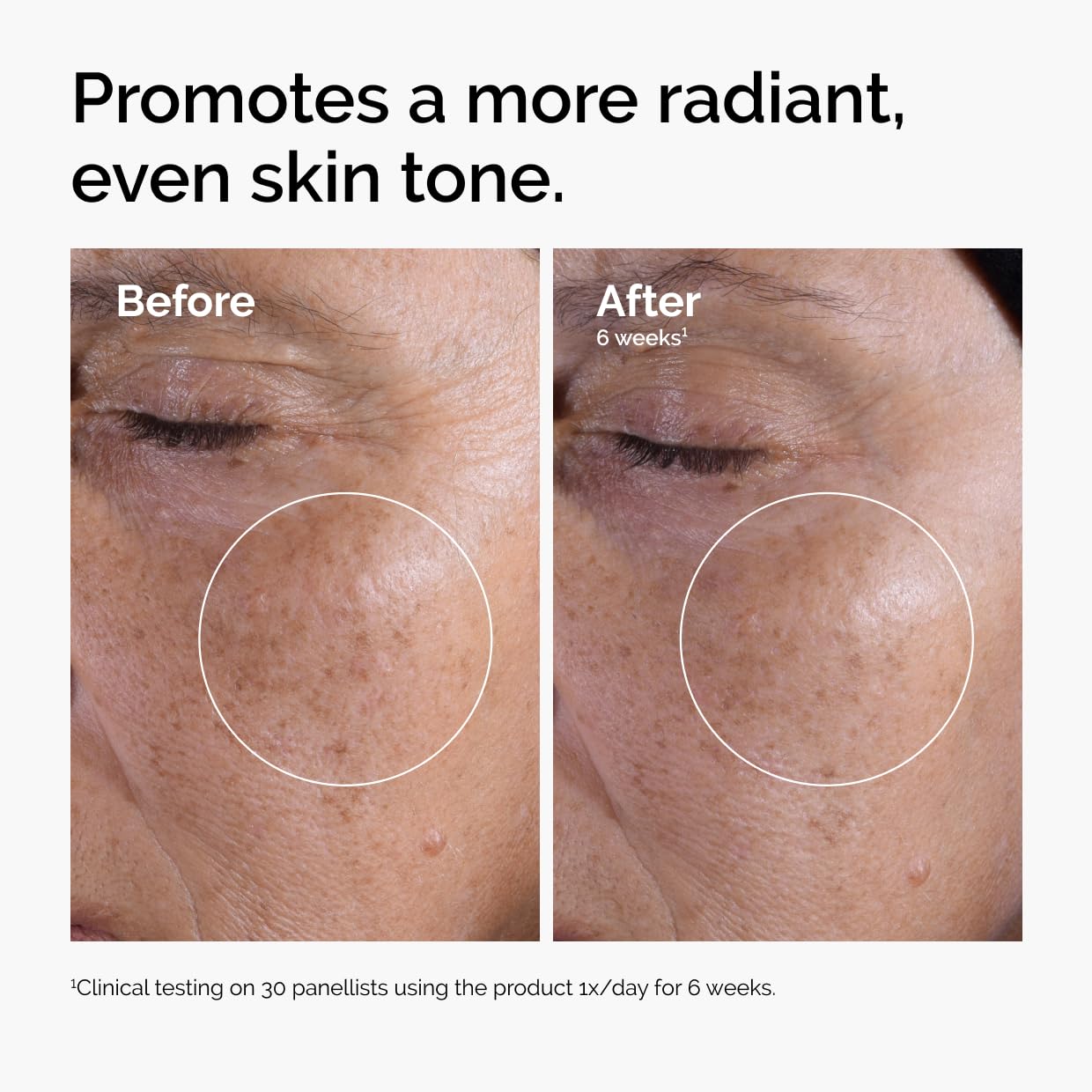 The Ordinary Glycolic Acid 7% Exfoliating Toner, Brightening And Smoothing Daily Toner For More Even-Looking Skin Tone, 3.4 Fl O