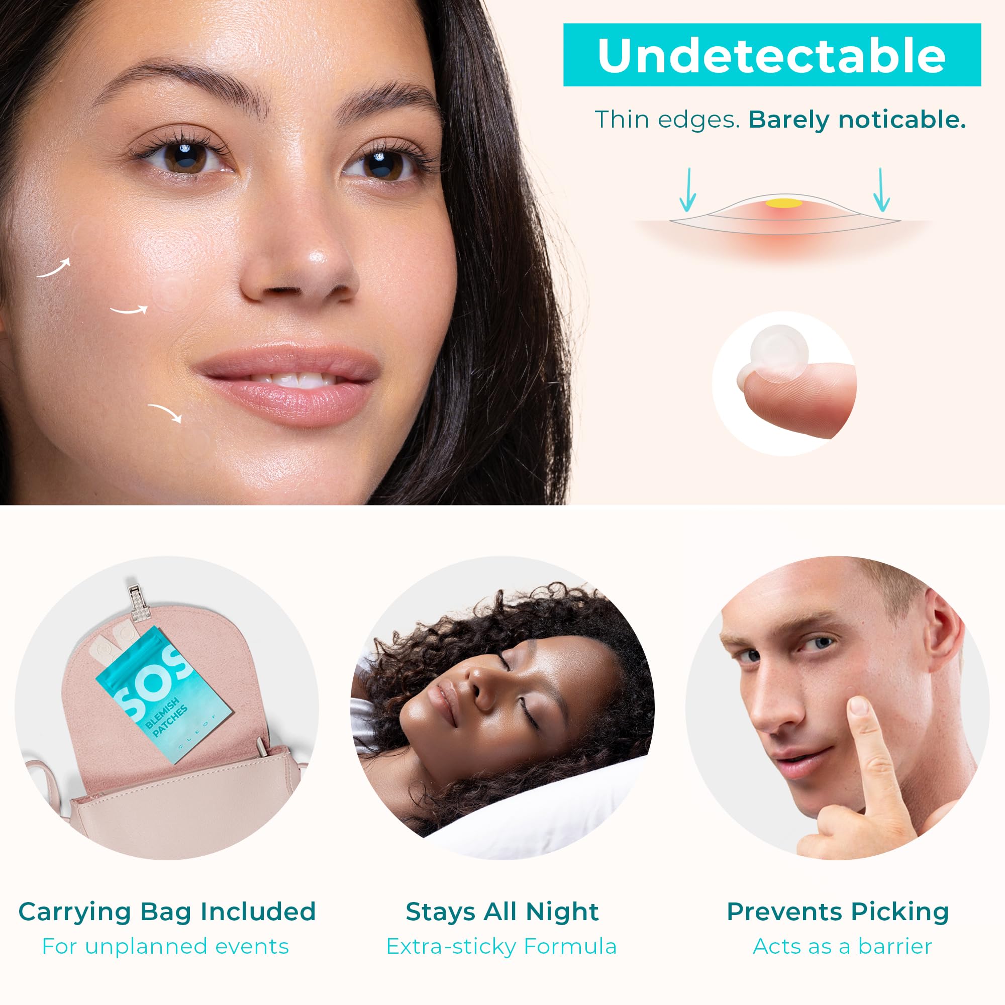 CLEOF Pimple Patches for Face & Body - Overnight Treatment - Acne Patch for Zits, Dots, Bumps, Spots, Pimples, Whiteheads - Hydr