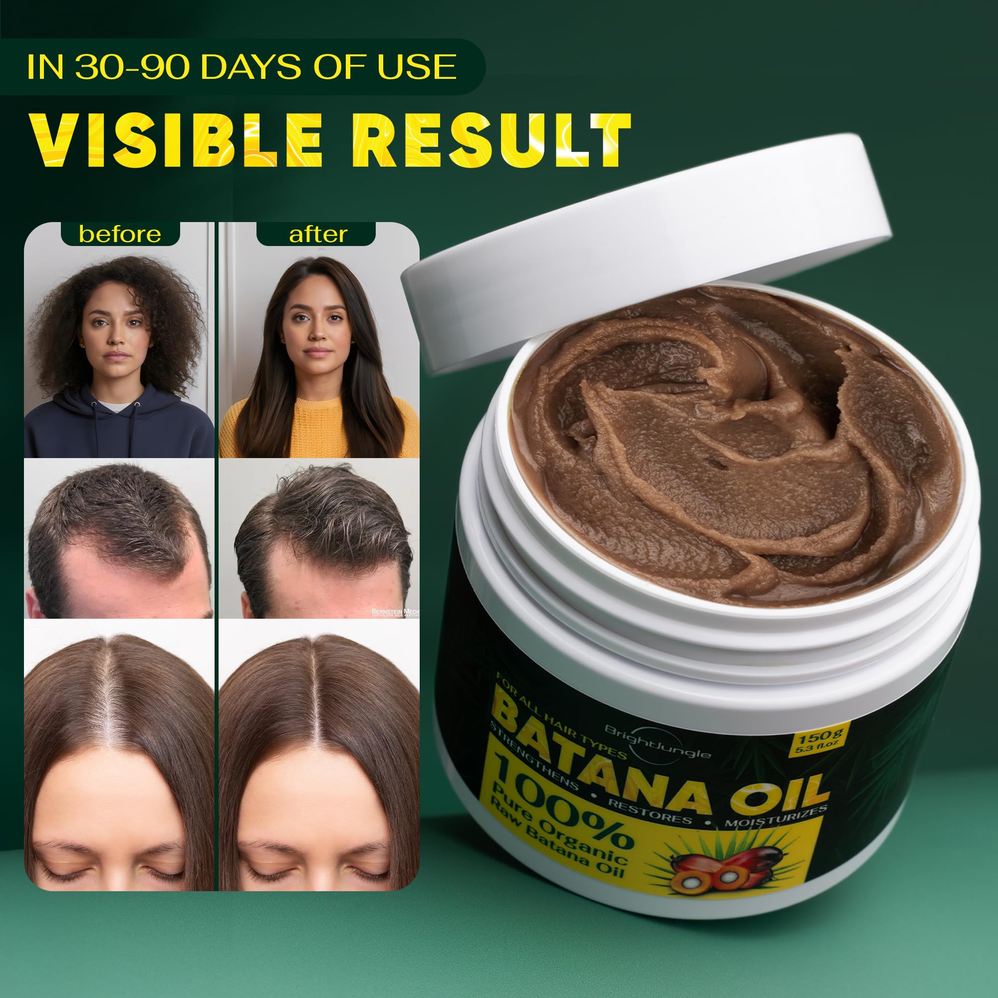 BRIGHTJUNGLE Raw Batana Oil for Hair Growth - 100% Pure, Organic, 5.3oz - Nourishing Hair & Scalp Oil for Men & Women