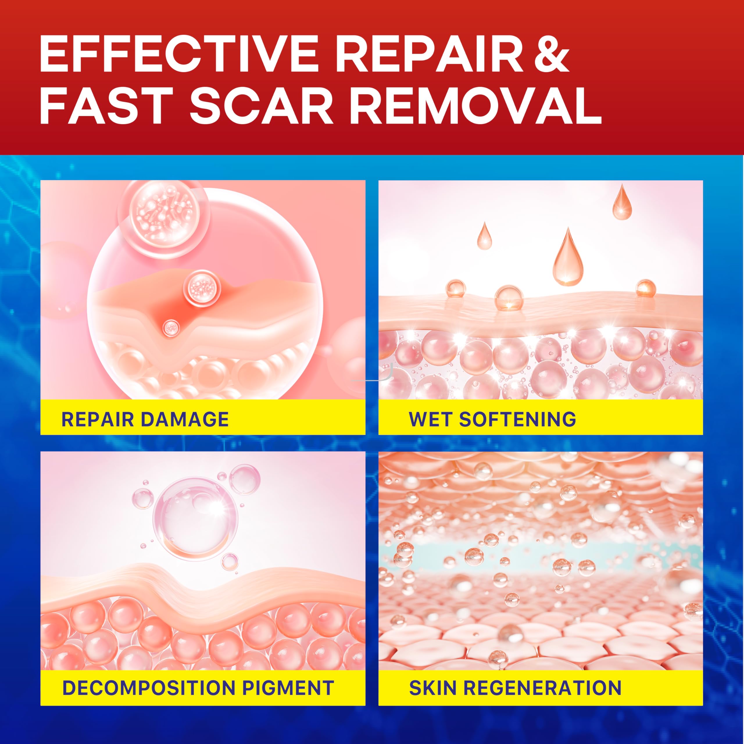 1.6''X 120'' Medical Silicone Scar Tape For Scars: Medical Grade Scar Sheets Reduces The Appearance Of Scars From Surgical Acne