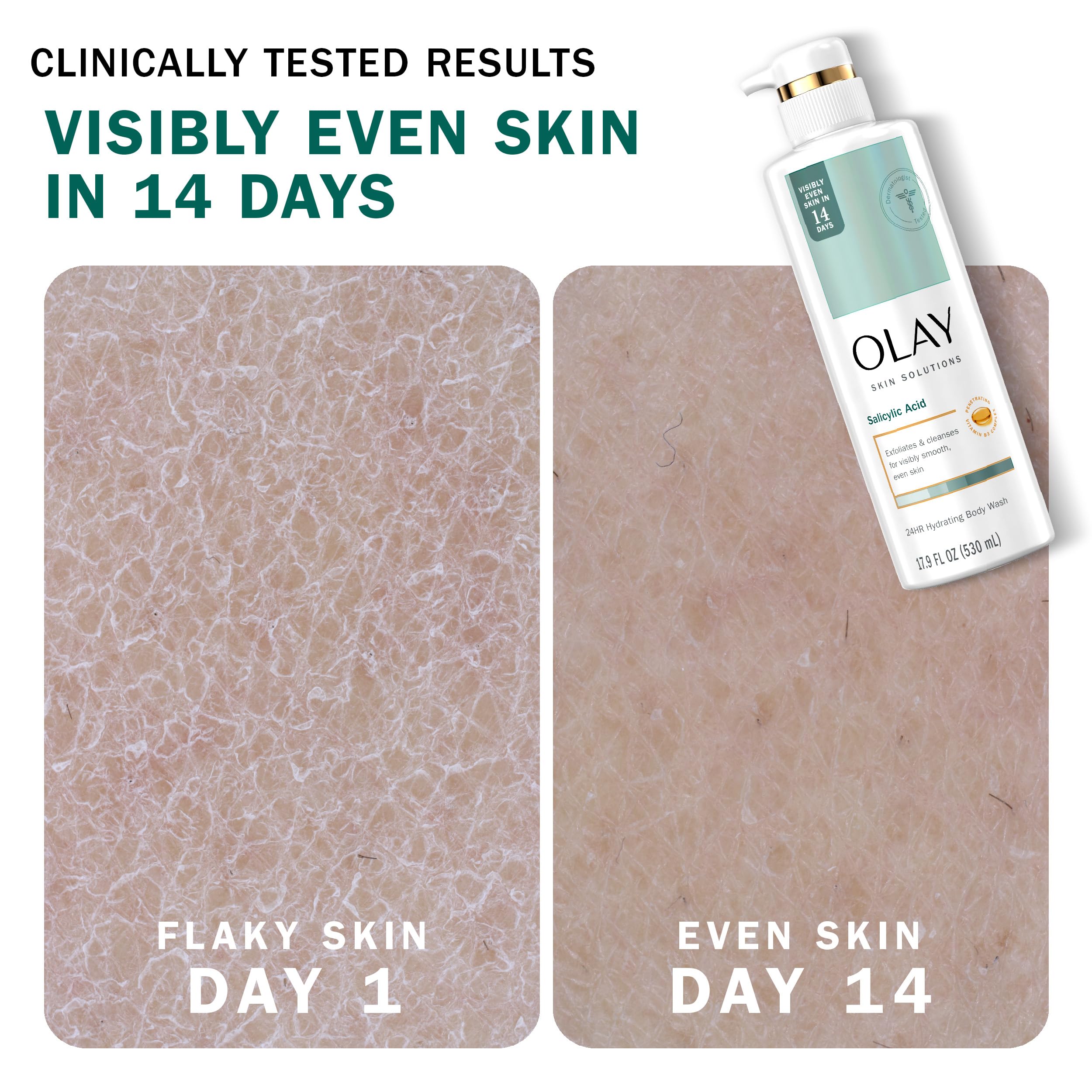 Olay Skin Solutions Hydrating Body Wash for Women with Salicylic Acid, 17.9 fl oz (Pack of 4)
