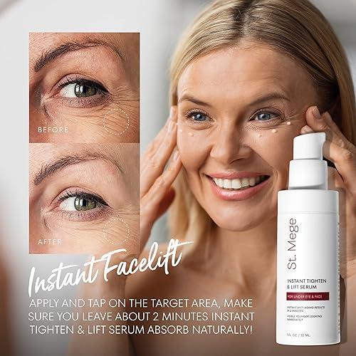 St. Mege Face Lift Cream - Instant Skin Tightening & Eye Lift, 1 oz, Smooths Loose Skin in 2 Minutes, Anti-Aging Treatment