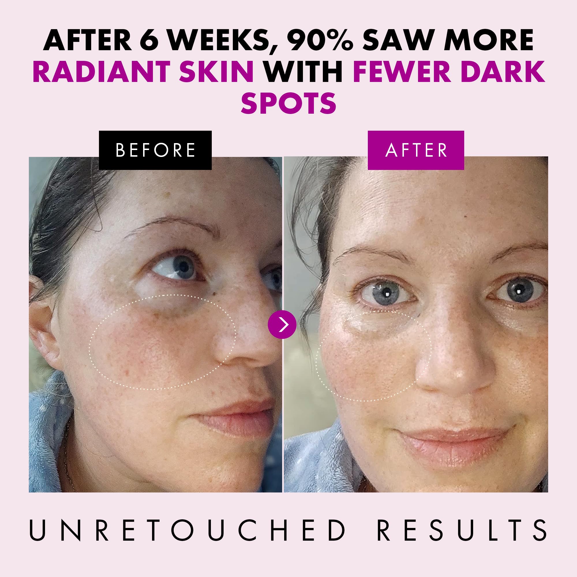 Collagen Anti Aging Face Cream with Patented Matrixyl-3000 & Argireline - 5x More Powerful w/ Pep-Boost Peptide Complex + 10 Ant