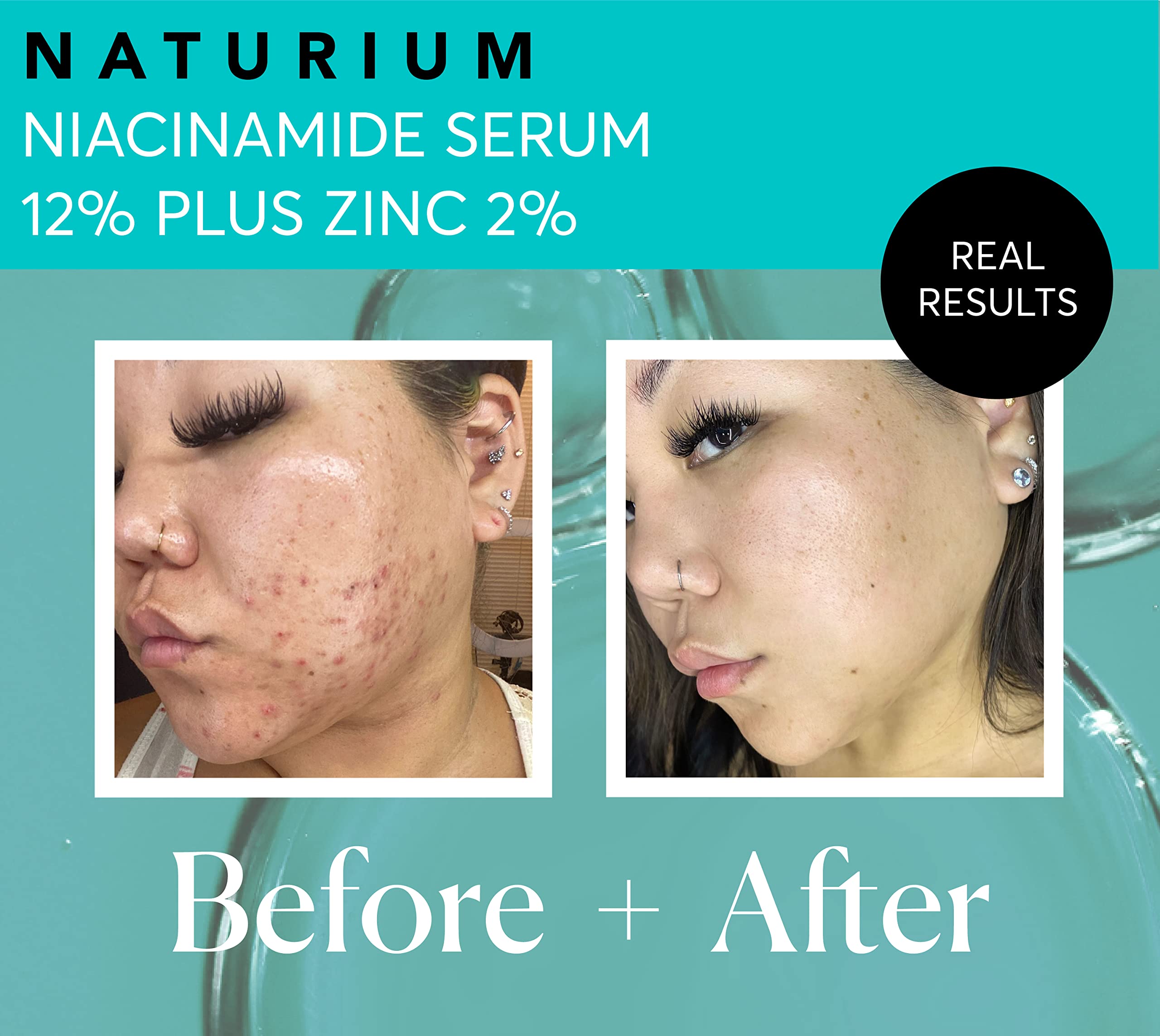 Naturium Niacinamide Face Serum 12% Plus Zinc 2%, Anti-Aging, Pore Minimizer & Dark Spot Corrector With Hyaluronic Acid & Vitami