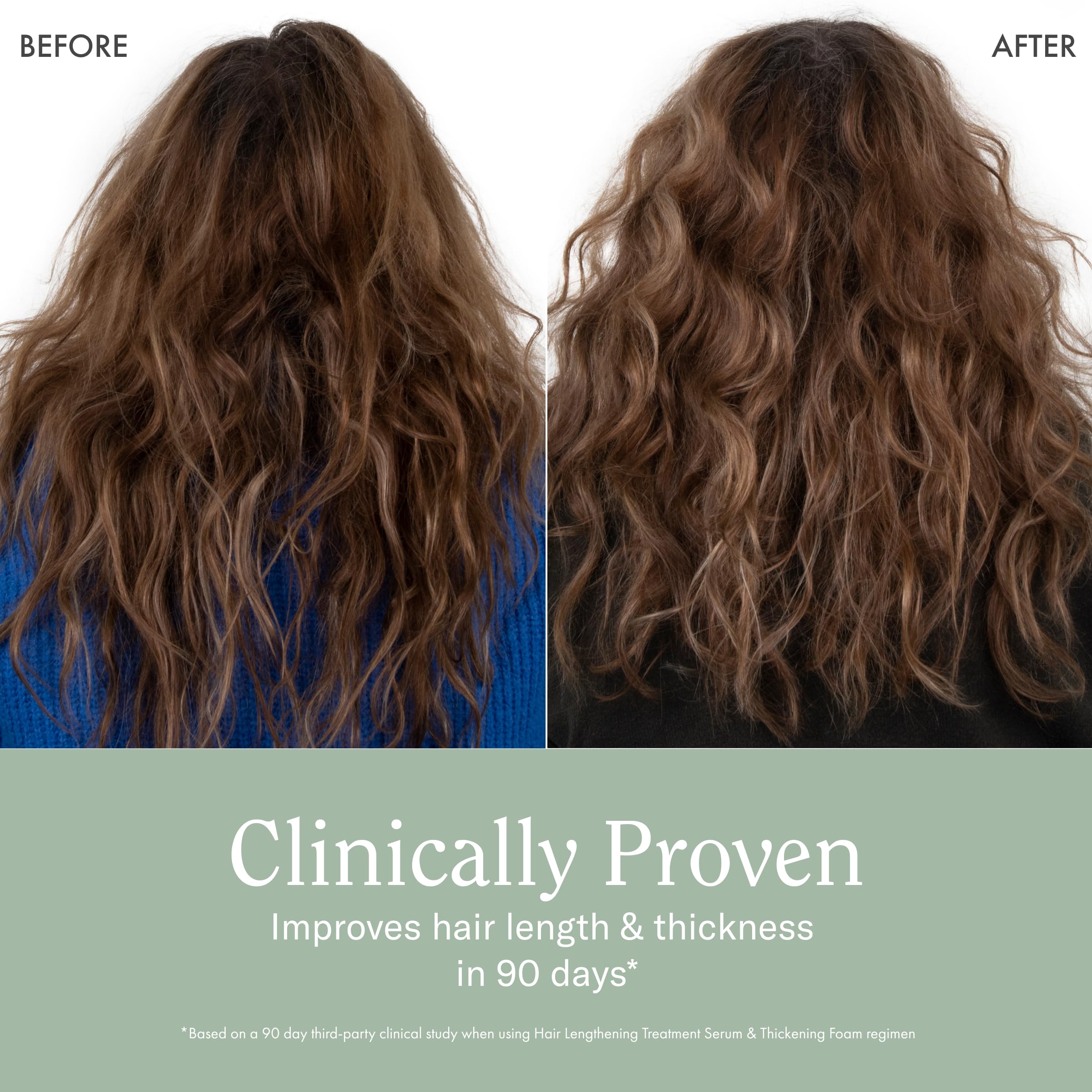 Rizos Curls Hair Lengthening Treatment Serum, Fortifies At Root For Healthy Scalp Microbiome Promoting Length, Supportes Longer