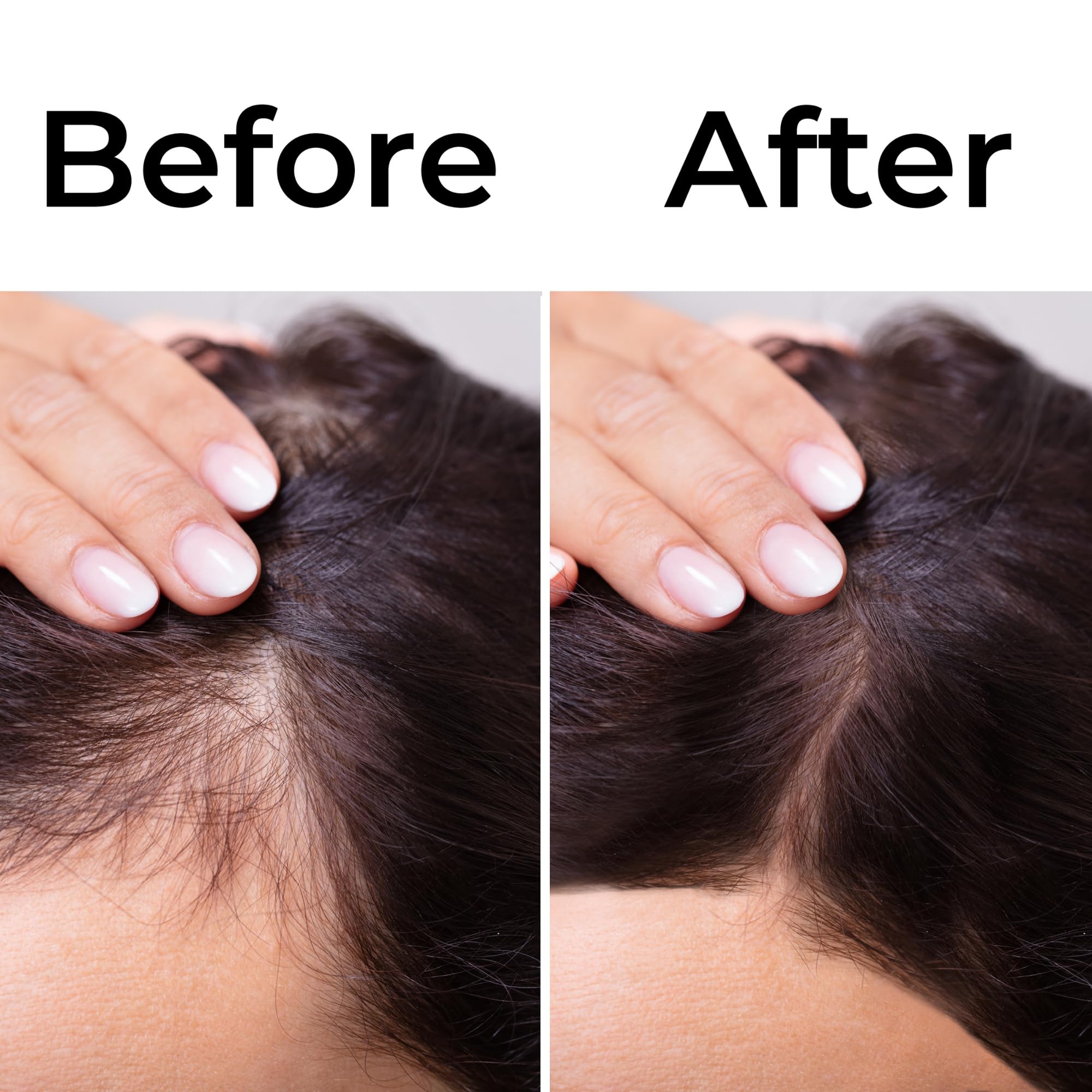 Virgin Hair Fertilizer And Energizer With Biotin (Edge Regrowth Cream)