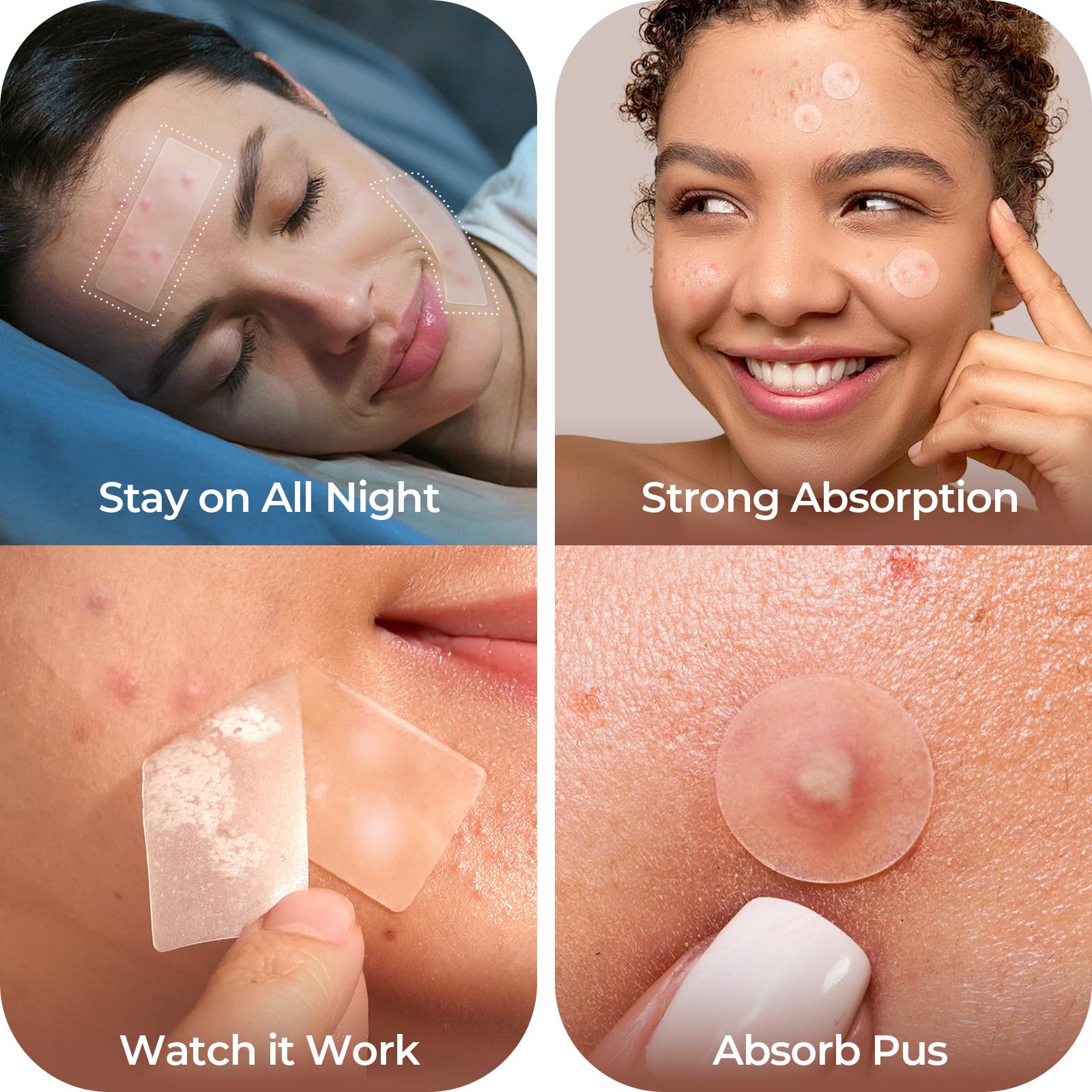 LitBear Large Pimple Patches, 5 Sizes 212 Counts Big Acne Patches for Face, Forehead, Body and Back, Hydrocolloid Bandages for Z