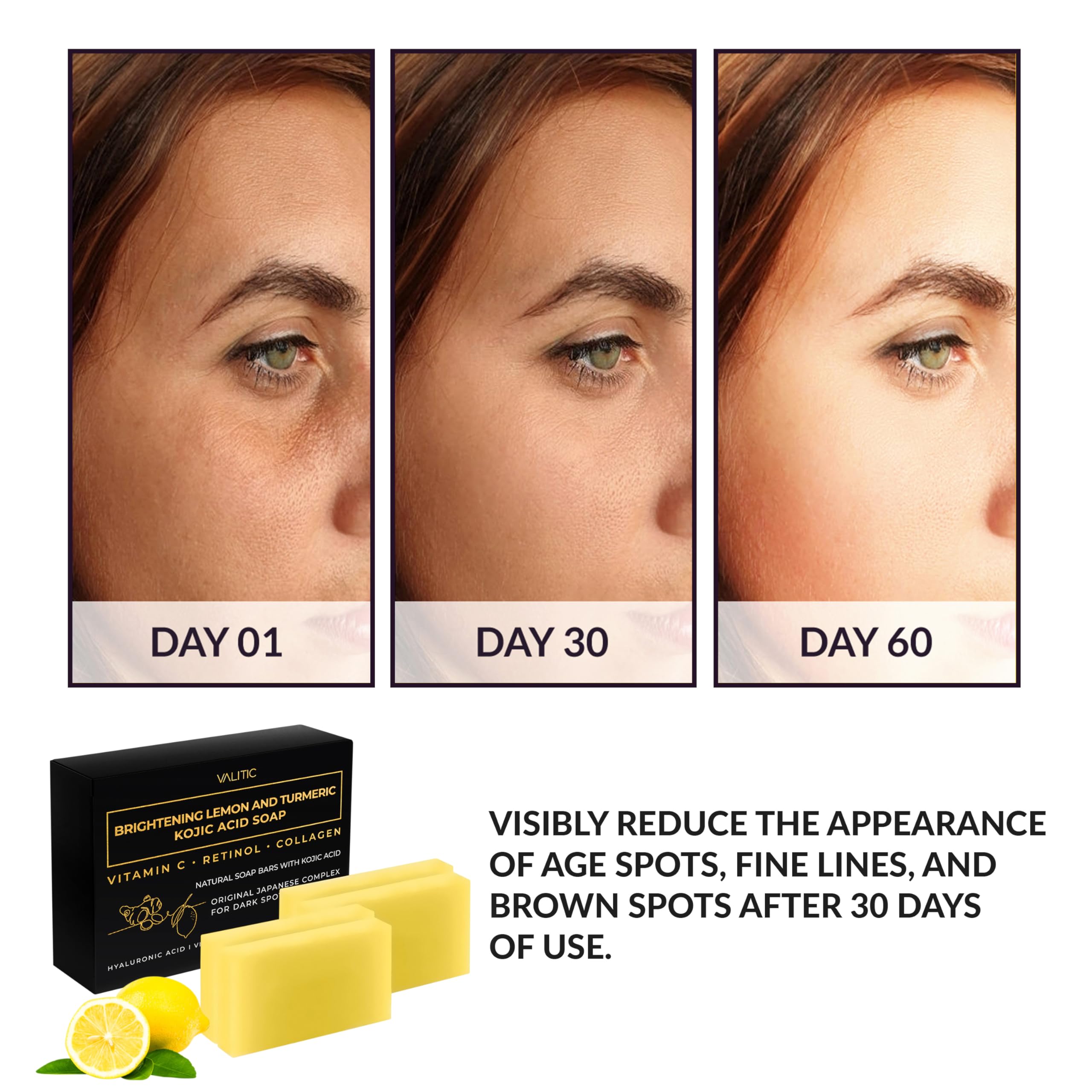 Valitic Brightening Lemon & Turmeric Kojic Acid Soap With Vitamin C, Retinol, Collagen - Original Japanese Complex Infused With