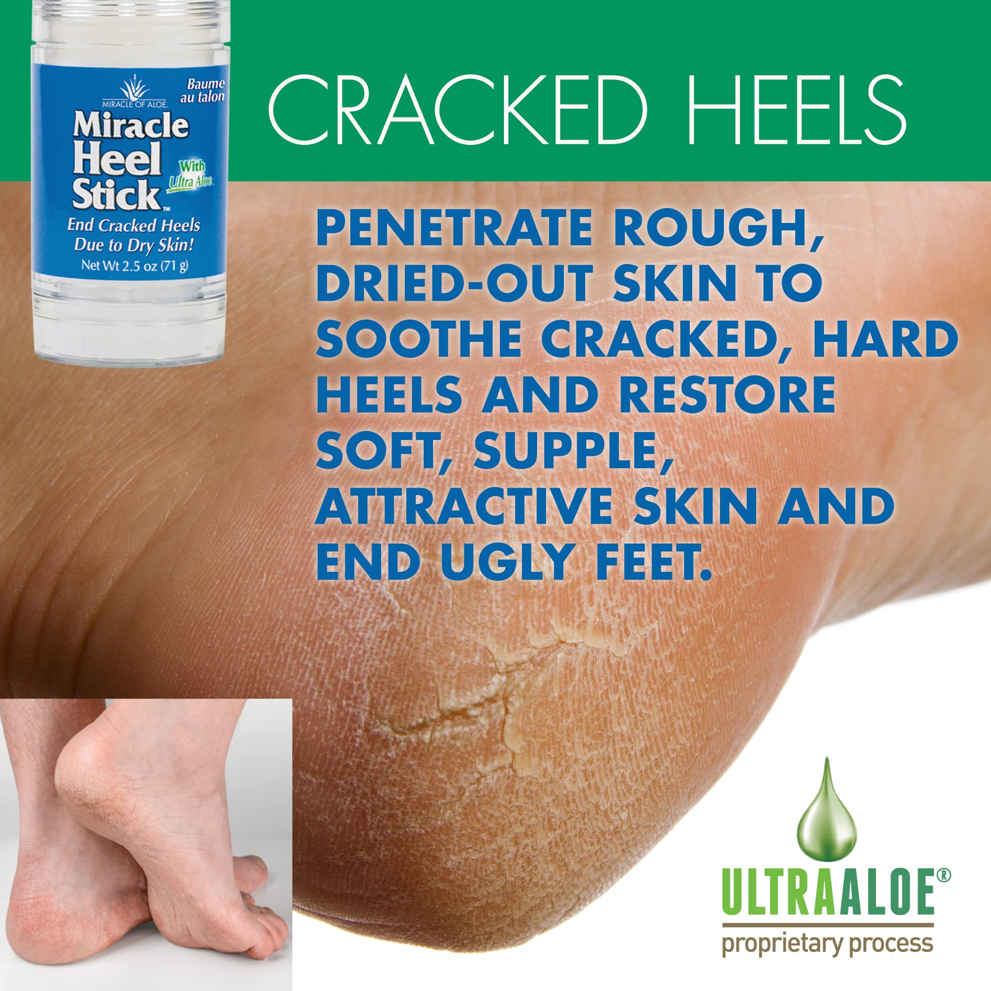 Miracle Of Aloe, Miracle Heel Stick - Gel Socks Combo With Ultraaloe, 2.5 Ounce Stick And Silicone Moisturizing Gel Heel Socks