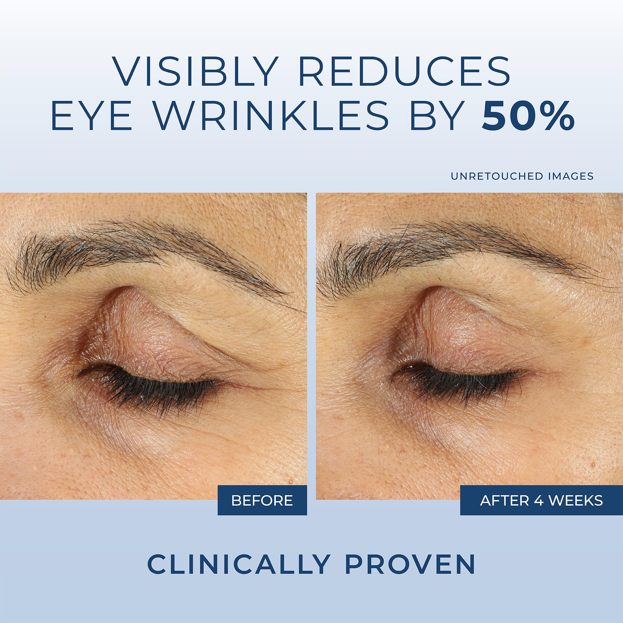 RoC Retinol Correxion Eye Cream Mini - Anti-Aging Treatment for Dark Circles & Puffiness, 0.25 Fl Oz, White