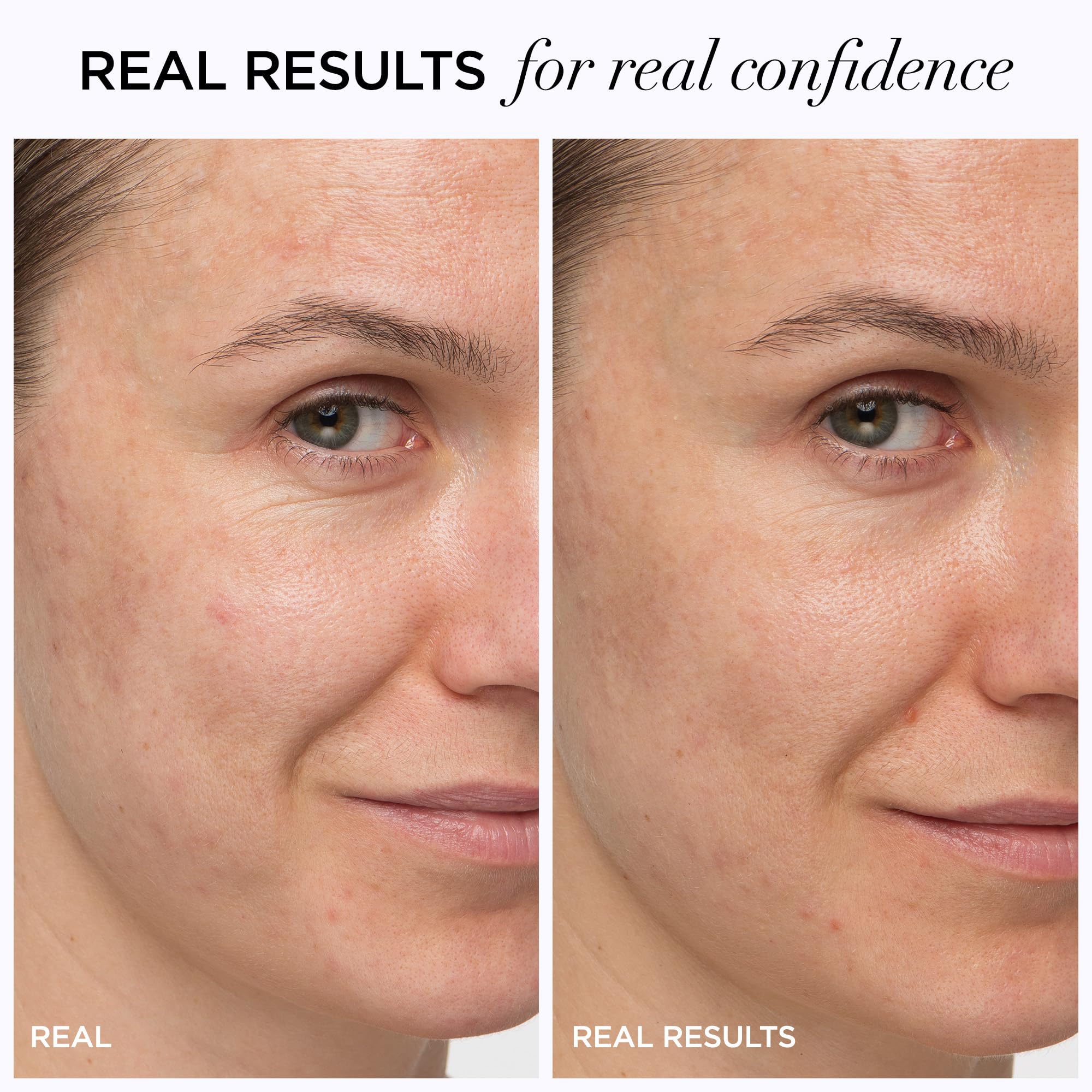 It Cosmetics Confidence In A Cream Anti Aging Face Moisturizer - Visibly Reduces Fine Lines, Wrinkles & Signs Of Aging Skin In 2