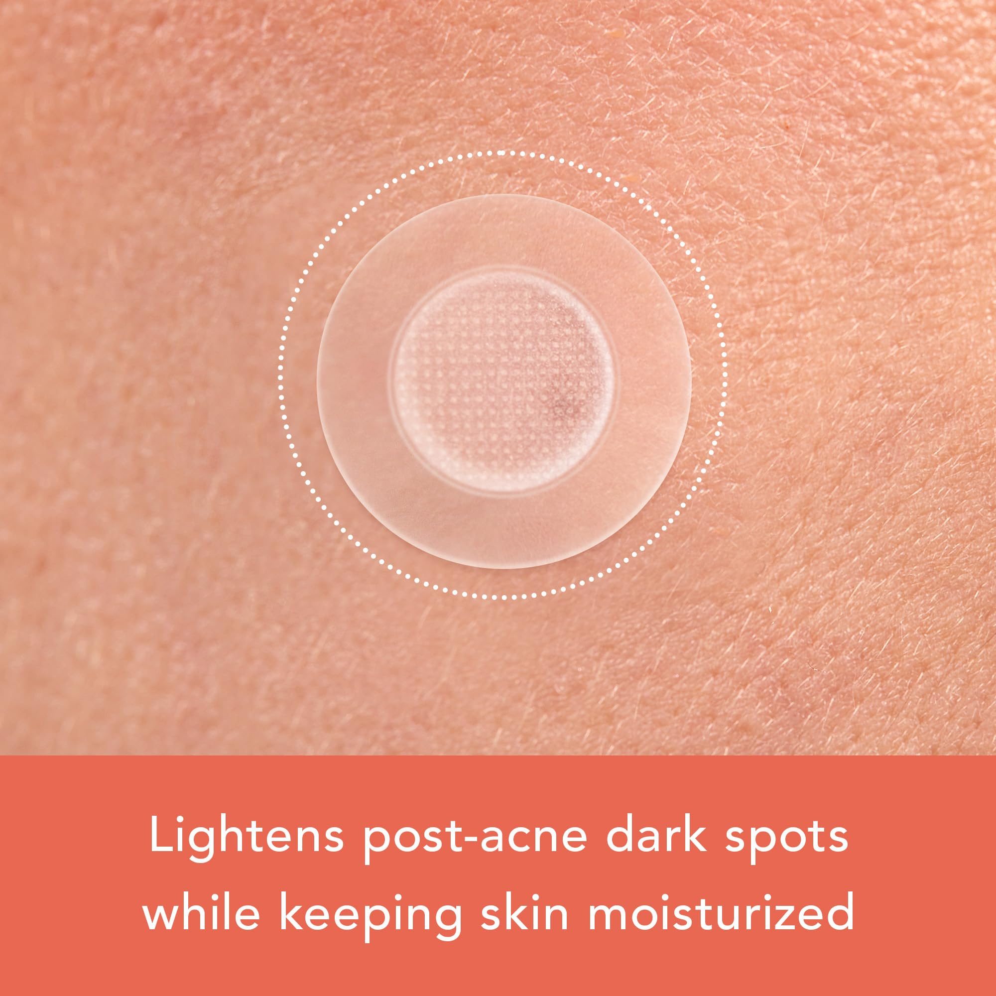 Rael Miracle Microcrystal Dark Spot Cover - Hydrocolloid, Post Acne Dark Spots, Skin Care, With Skin Brightening Ingredients (6