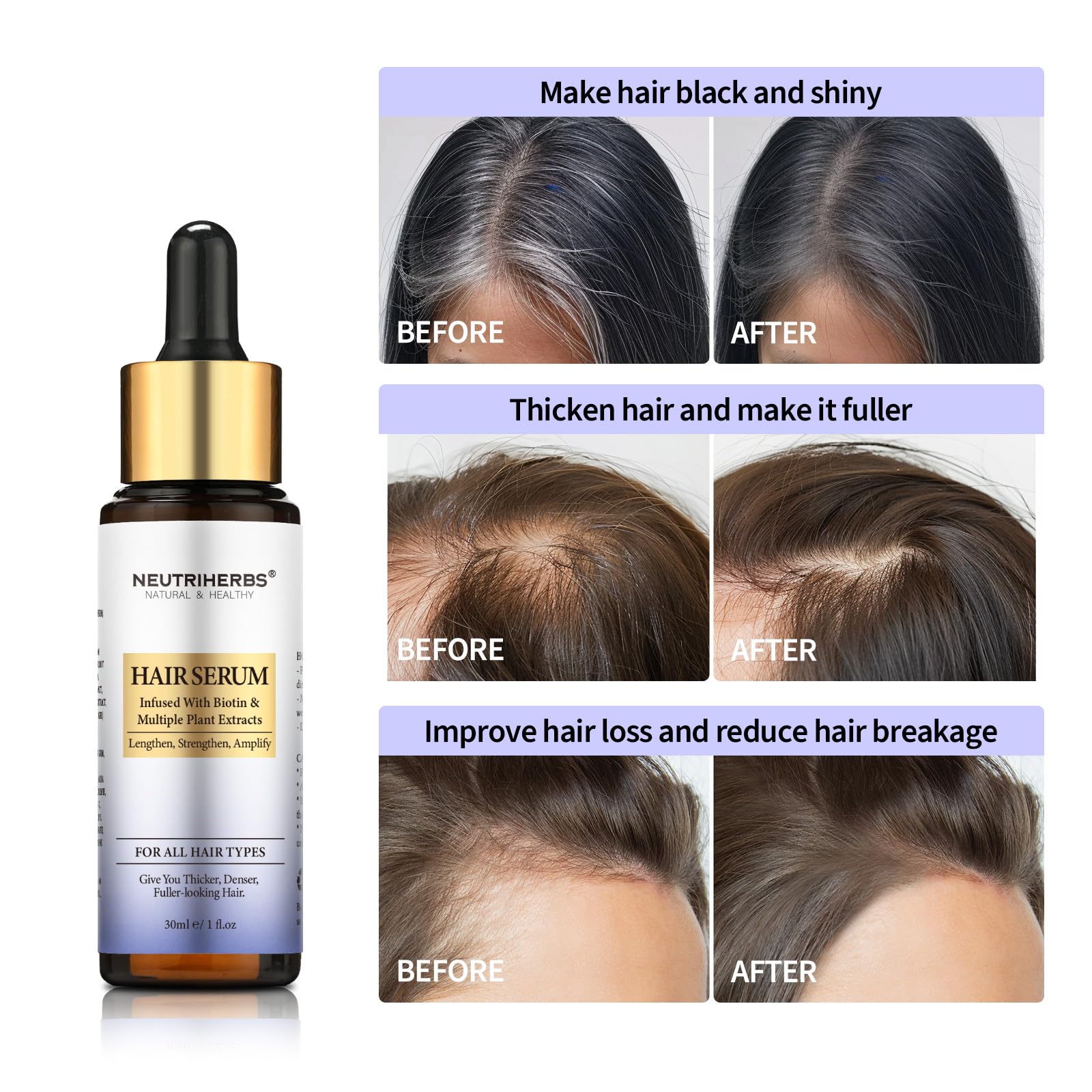 Neutriherbs Hair Growth Serum For Women and Men,Hair Serum With Biotin and Peptides,for Hair Loss,Thinning Hair,Get Thicker, Ful
