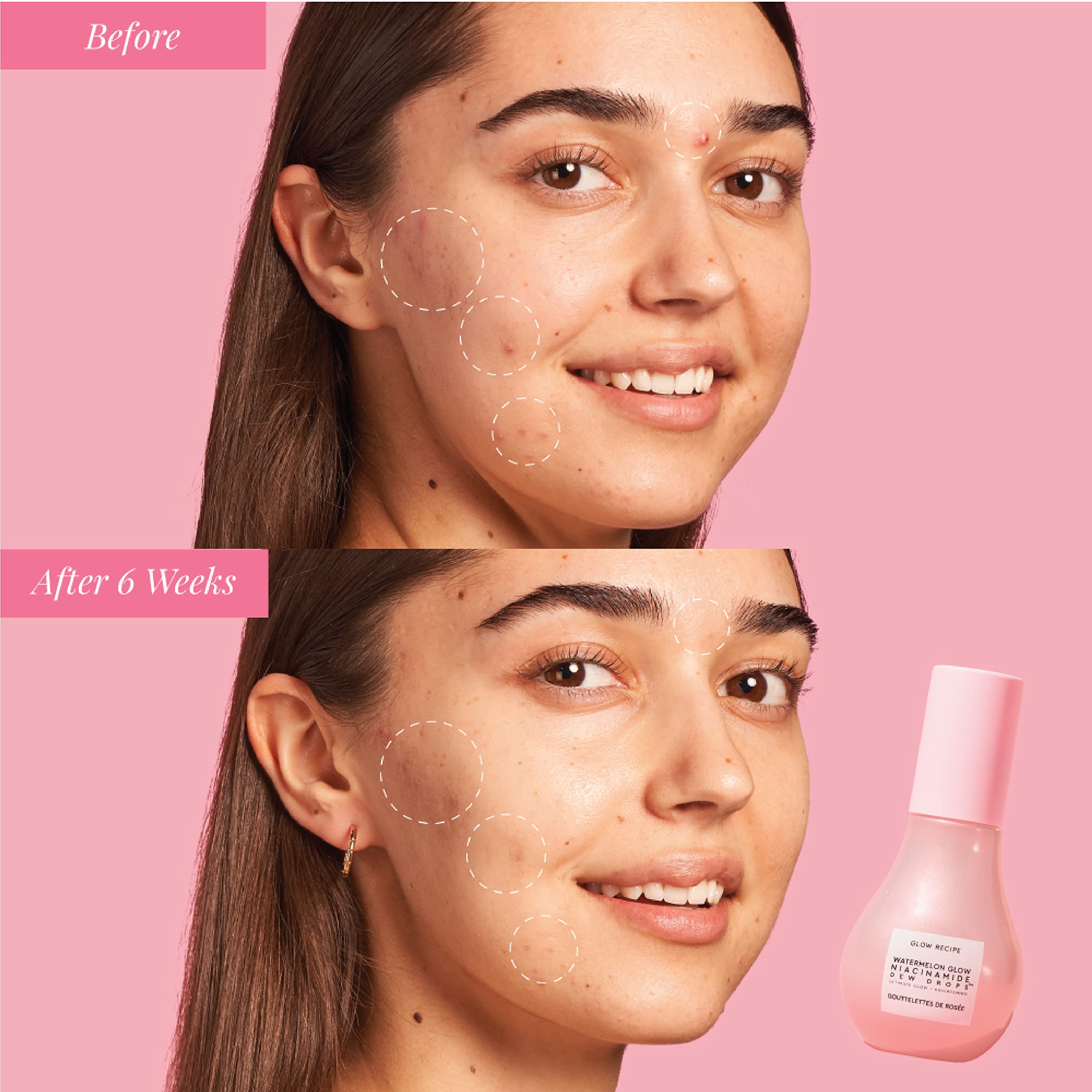 Glow Recipe Watermelon Glow Niacinamide Dew Drops Jumbo Size - Brightening Serum With Hyaluronic Acid & Moringa Oil + Vitamin E