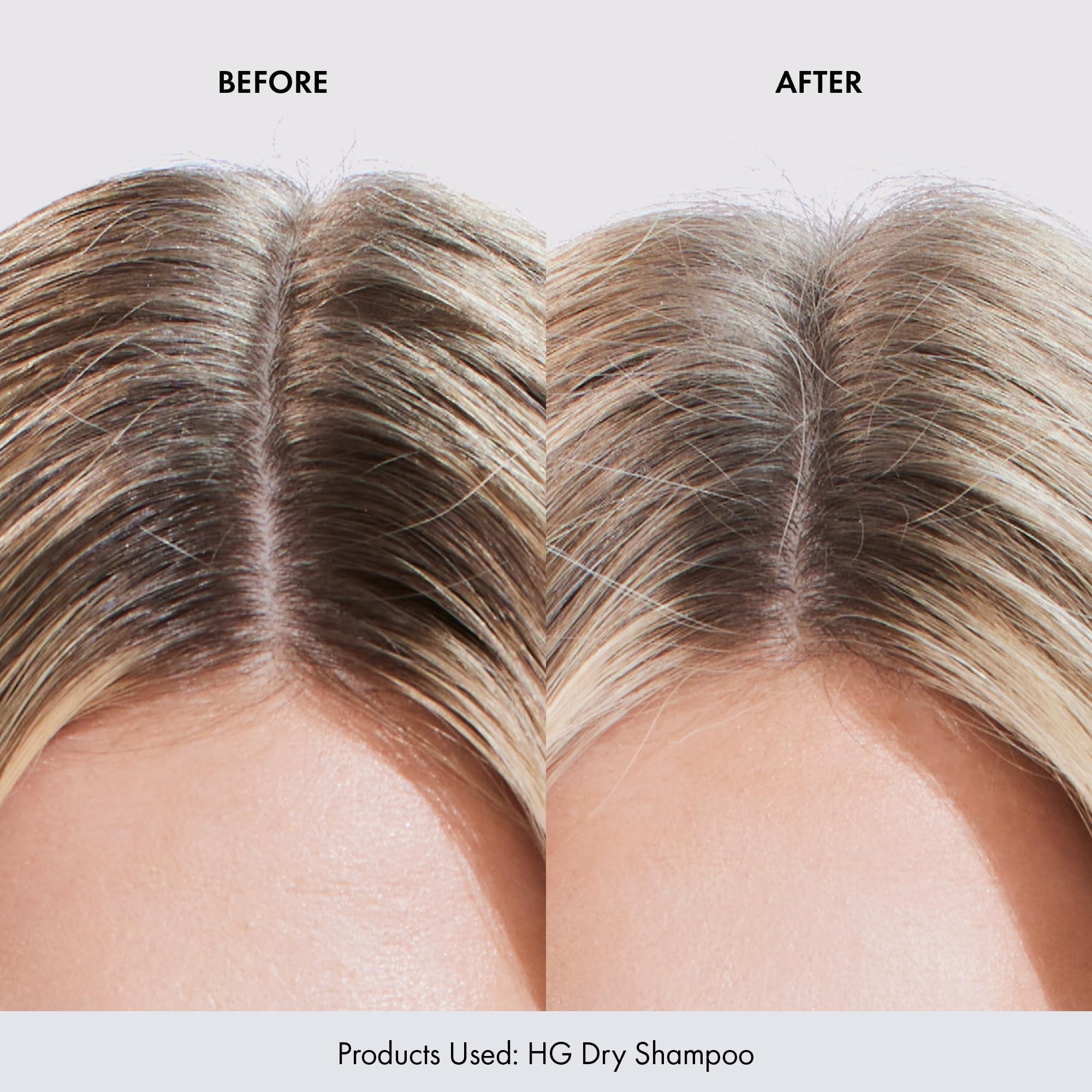 BONDIBOOST HG Dry Shampoo Spray [3.95 oz], Instantly Refresh + Protects & Strengthens Hair, Infused with Rosemary Oil, Works for