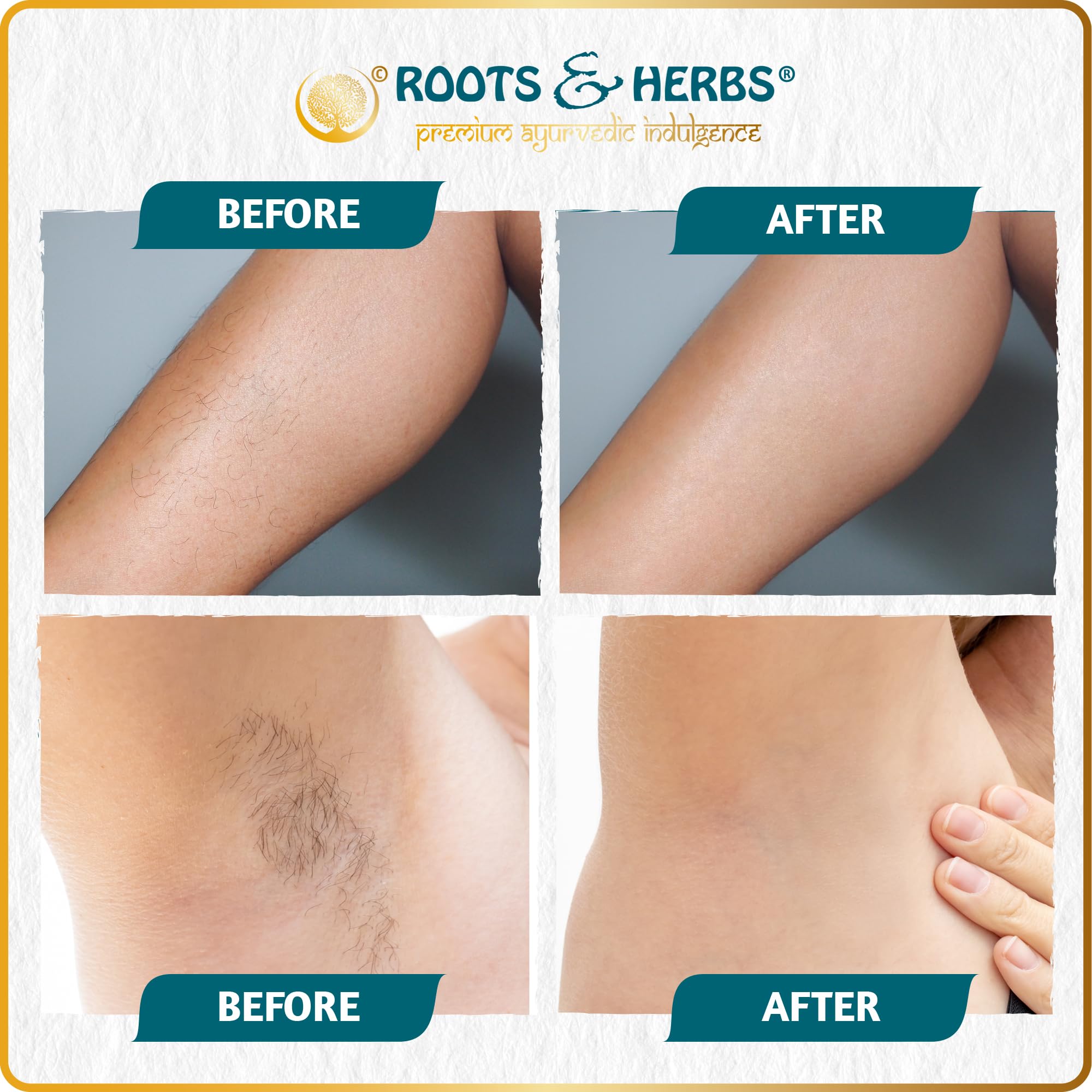 Neem & Fennel Hair Removal Mask - Bikini Hair Removal For Womens & Mens Legs, Underarm, & Chest - Depilatory Powder Body Hair Re