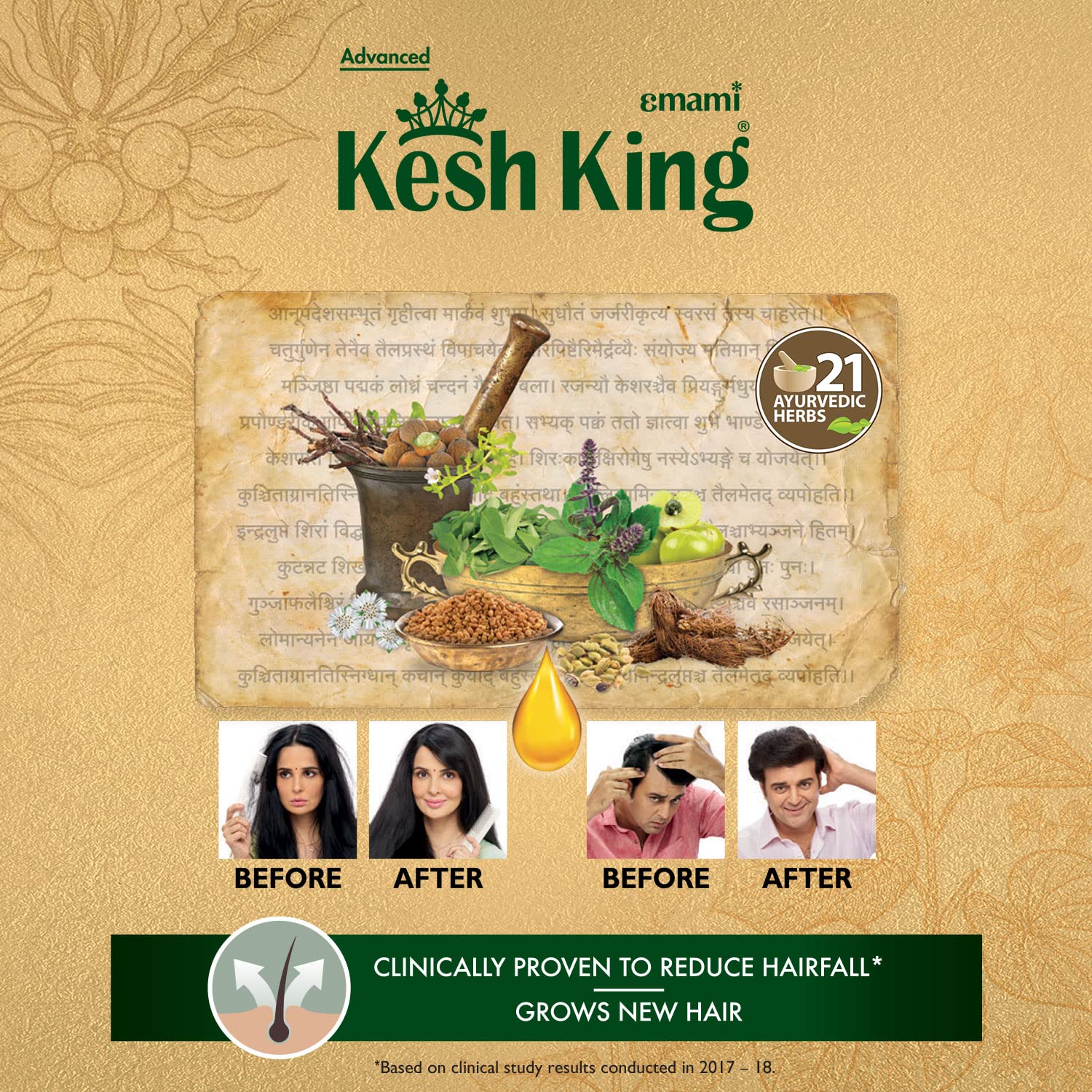 Kesh King Ayurvedic Scalp And Hair Oil, 100Ml (Hair Oil, 100Ml)