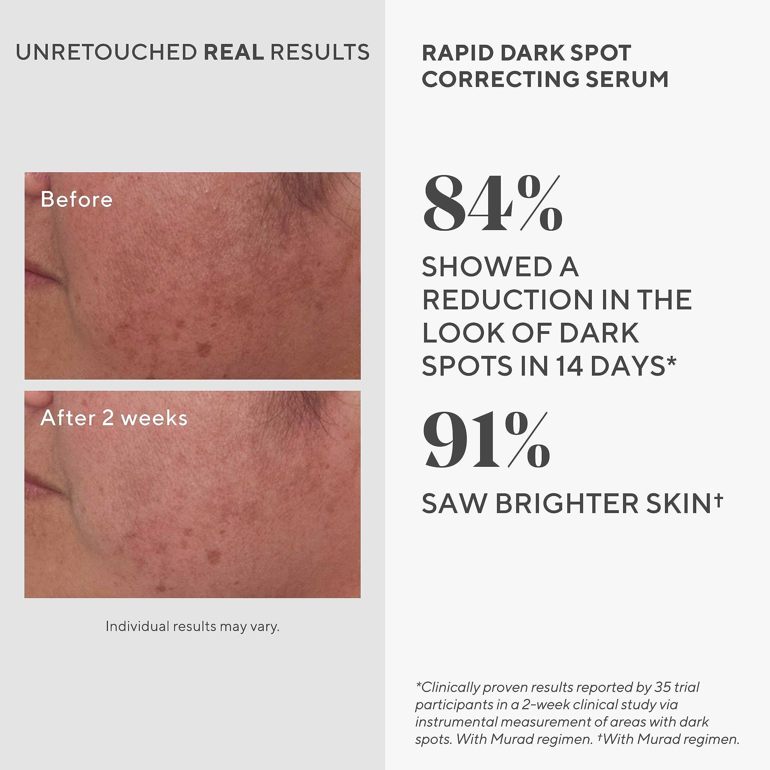 Murad Rapid Dark Spot Correcting Serum - Skin Brightening Face Serum For Hyperpigmentation - Glycolic Acid Treatment Backed By S