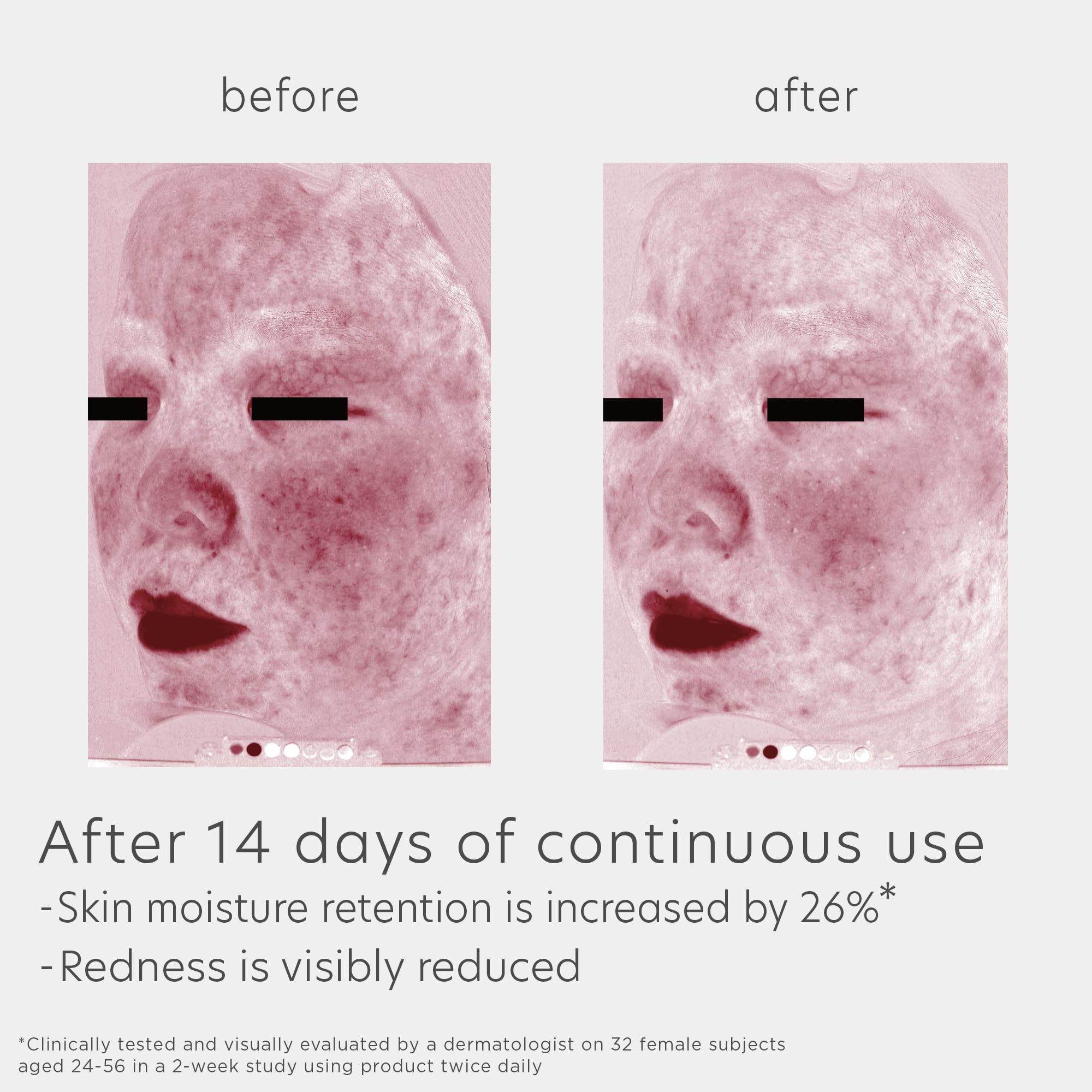 Eltamd Skin Recovery Amino Acid Foaming Facial Cleanser, Gentle Face Cleanser For Sensitive Skin, 5.0 Fl Oz