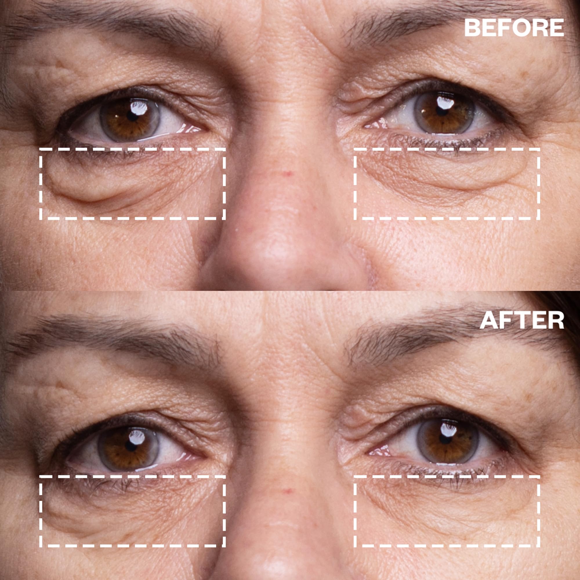 Wrinkles Schminkles Under Eye Patches - Rejuvenate Wrinkles with Medical Grade Silicone Reusable Anti-Wrinkle Patches for Under