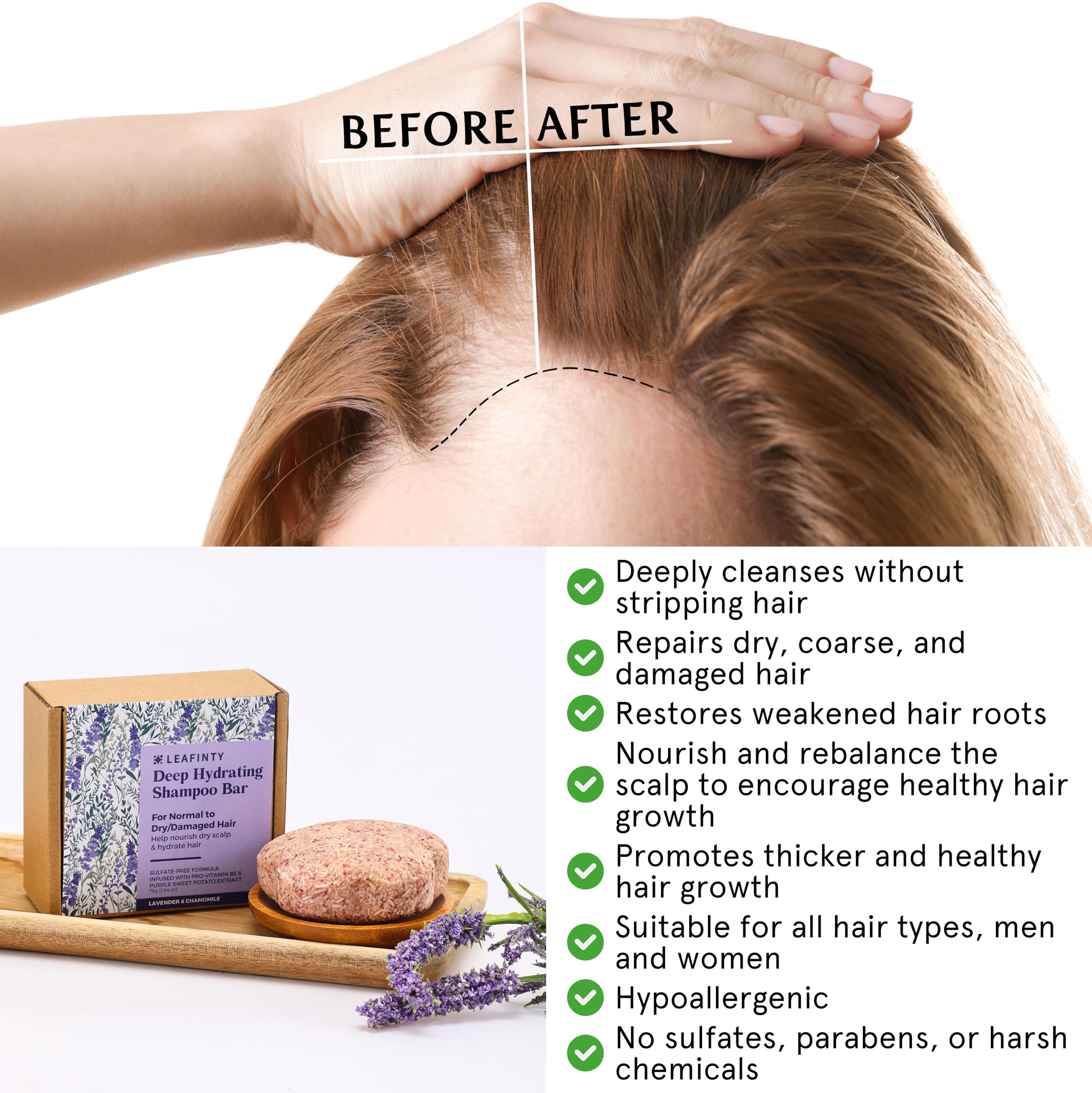 Leafinty Shampoo Bars for Hair Growth, Solid Shampoo Bar for Dry & Damaged Hair, Shampoo Bar with Holder, Deep Hydrating, Rebala