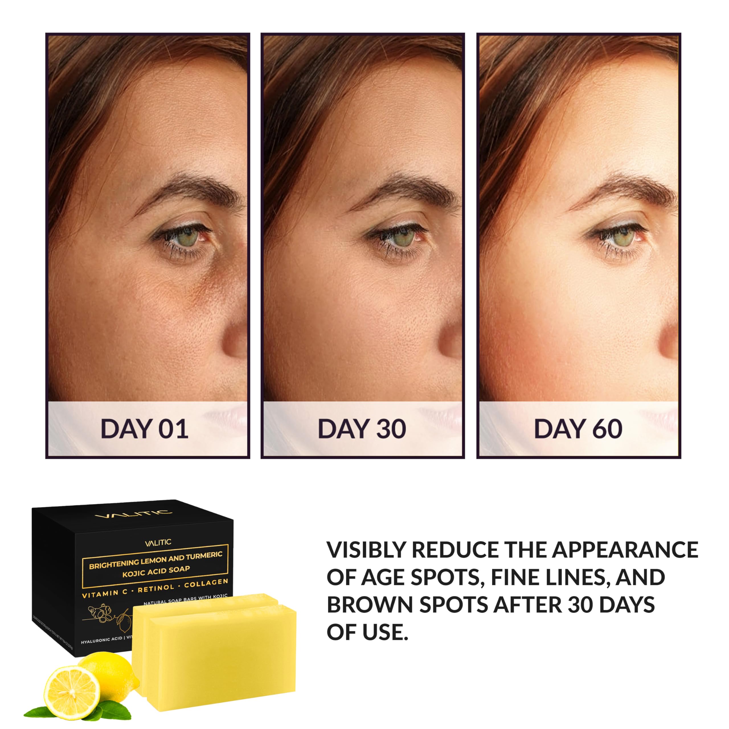 Valitic Brightening Lemon & Turmeric Kojic Acid Soap With Vitamin C, Retinol, Collagen - Original Japanese Complex - With Hyalur