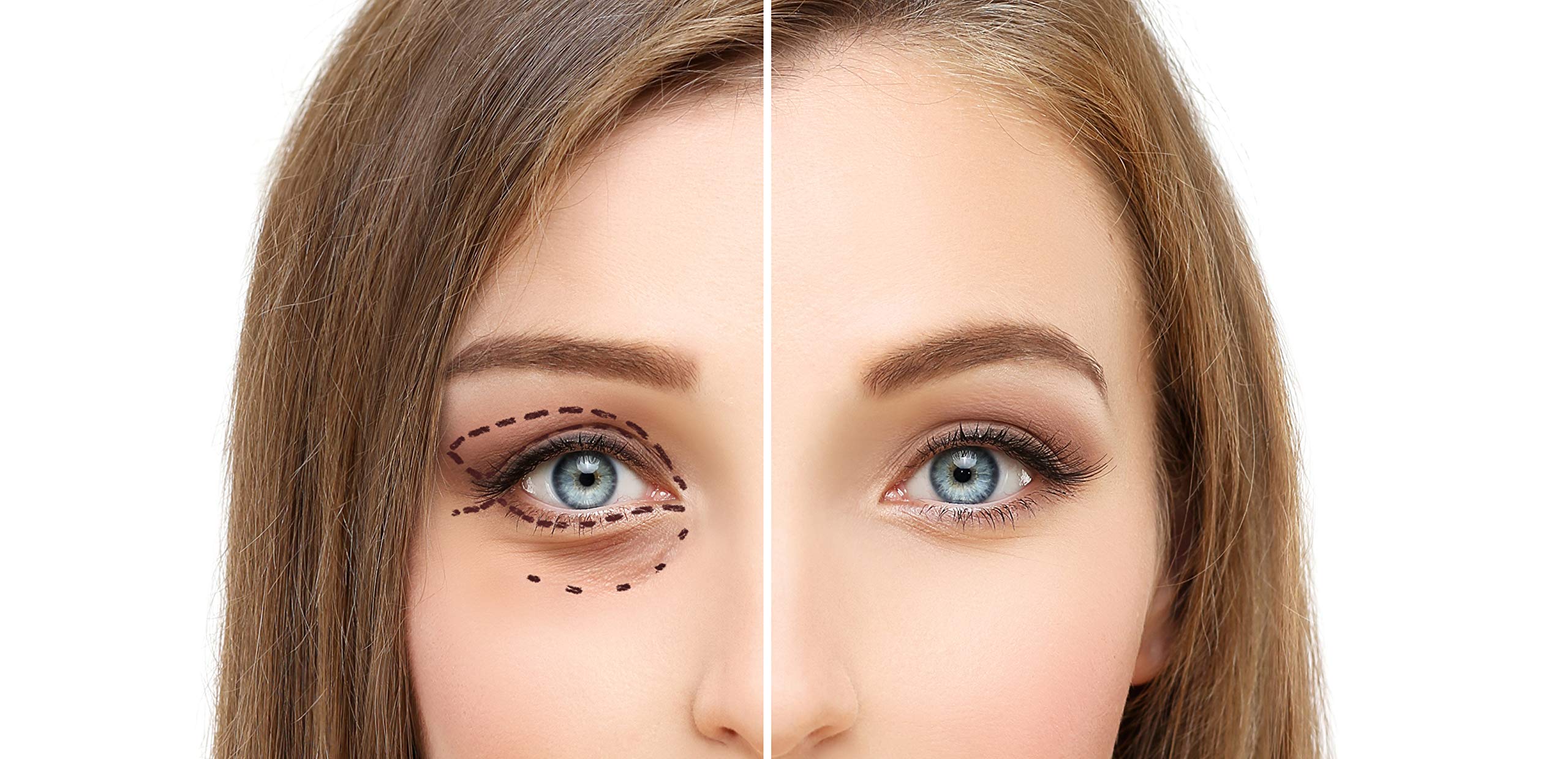 Osmotics Under Eye Rejuvenator, Anti Aging Eye Cream For Dark Circles, Eye Bags, Fine Lines, Puffiness. Best Anti Aging Eye Crea