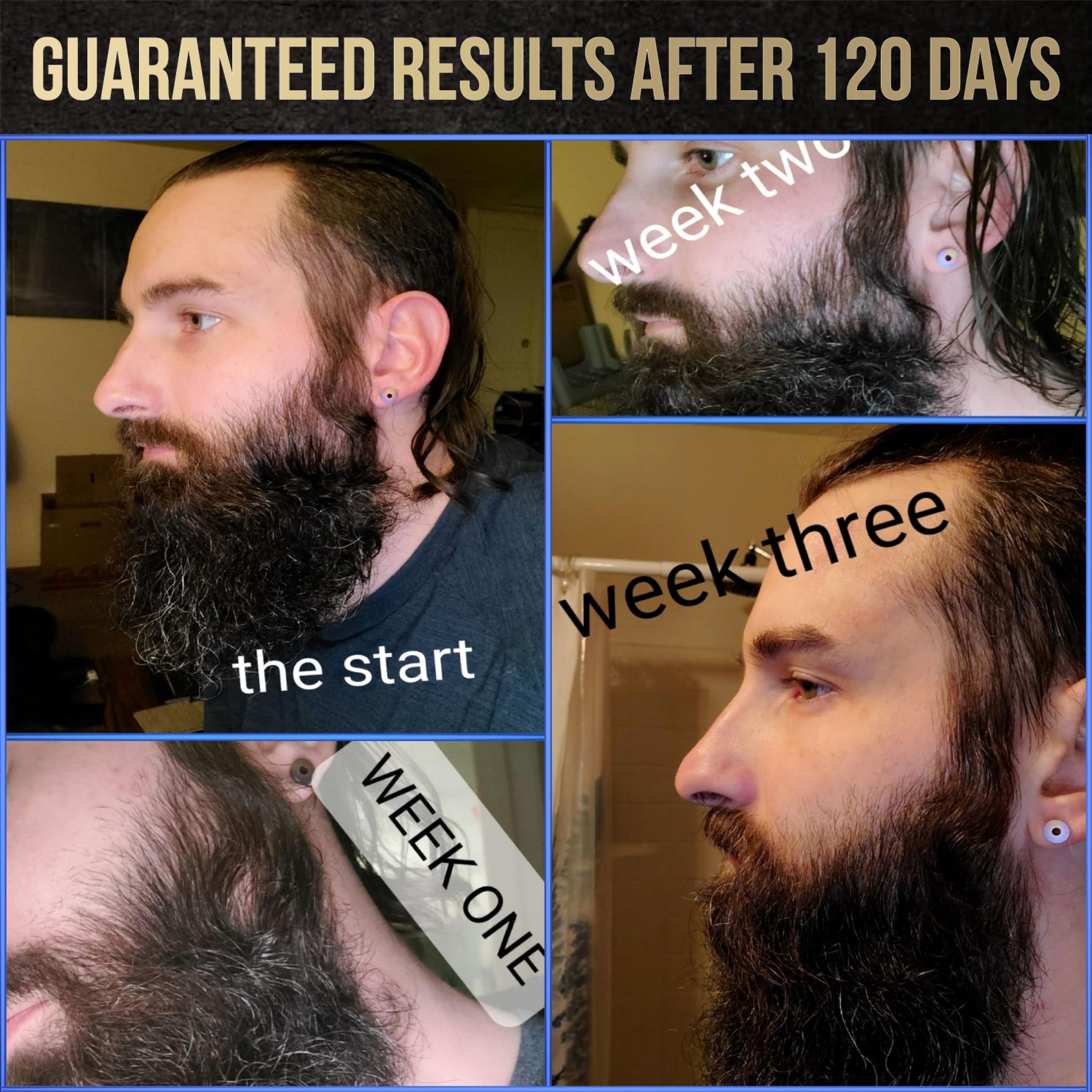 The Beard Struggle Voxtr Beard Growth Serum With Follicle Acceleration Matrix - Promotes Thicker & Healthier Beard - Beard Serum