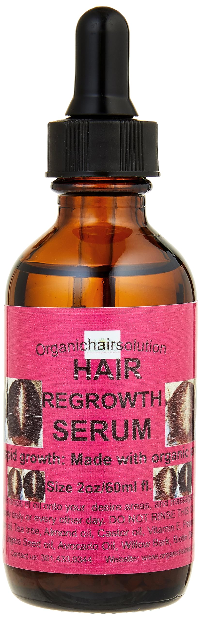 Edge growth Serum Scalp & Hair OilFor Strengthening  Growth, Thicker Longer Hairfor Split Ends &Dry Scalp Dandruff WithPepp