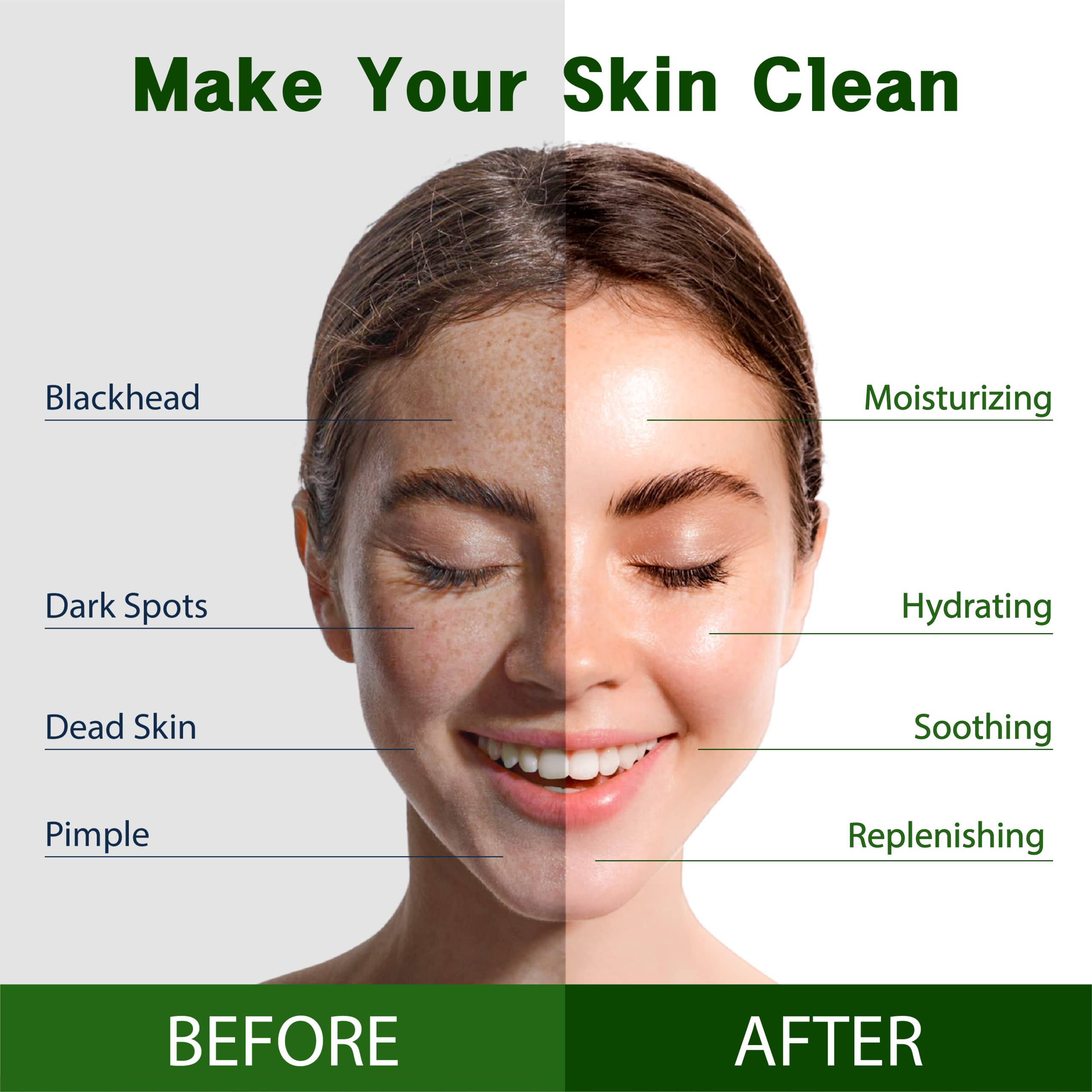 Purederm Vegan Aloe Sheet Masks (12 Packs) - Facial Sheet Mask For Soothing & Hydrating Treatment