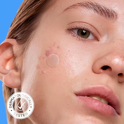 Avarelle Acne Cover Patch  Hydrocolloid Acne Pimple Patches  Zit Patches For Blemishes, Zits And Breakouts With Tea Tree, Calend