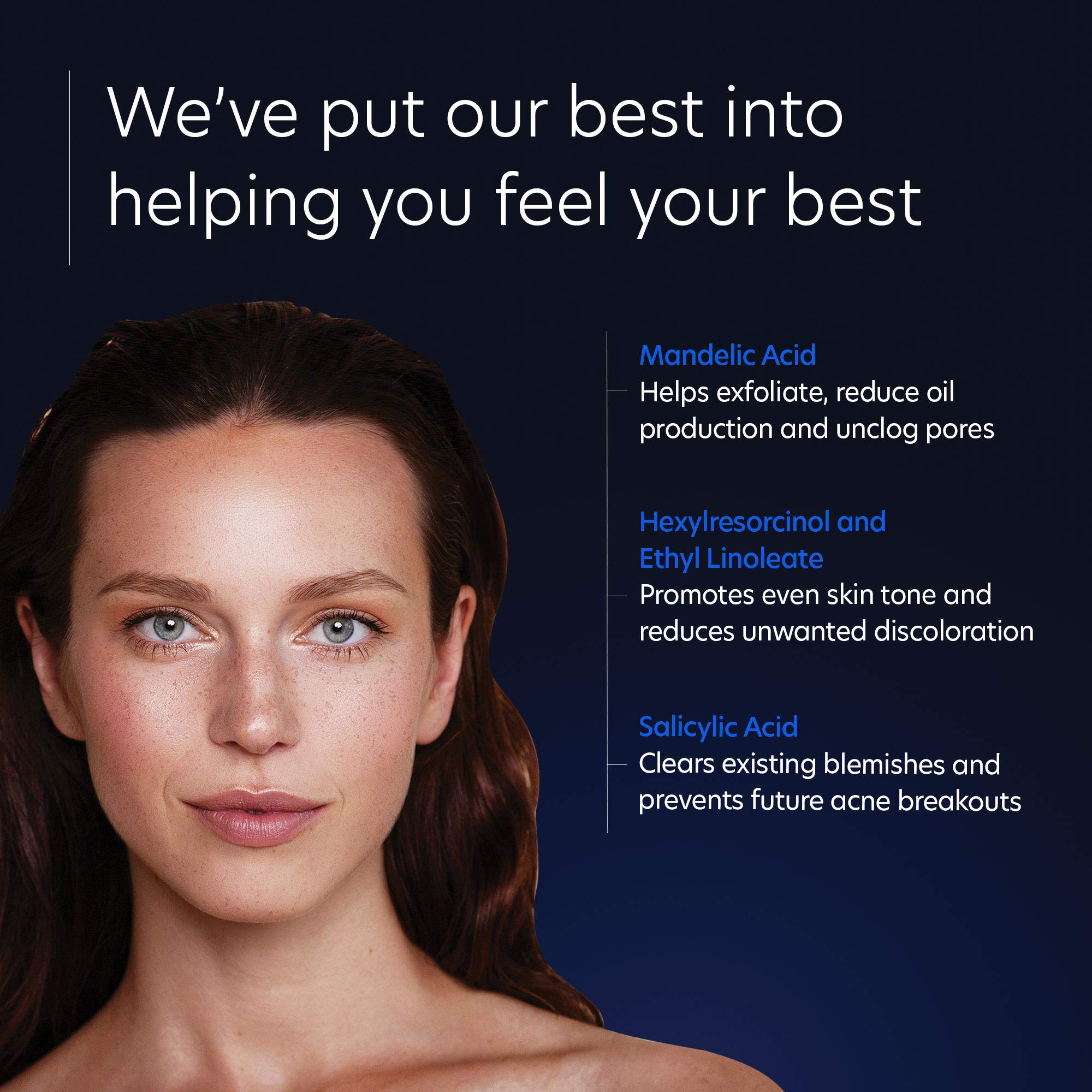 PCA SKIN Acne Gel - 2% Salicylic Acid Spot Treatment, Anti-Acne Serum, 1 fl oz Pump