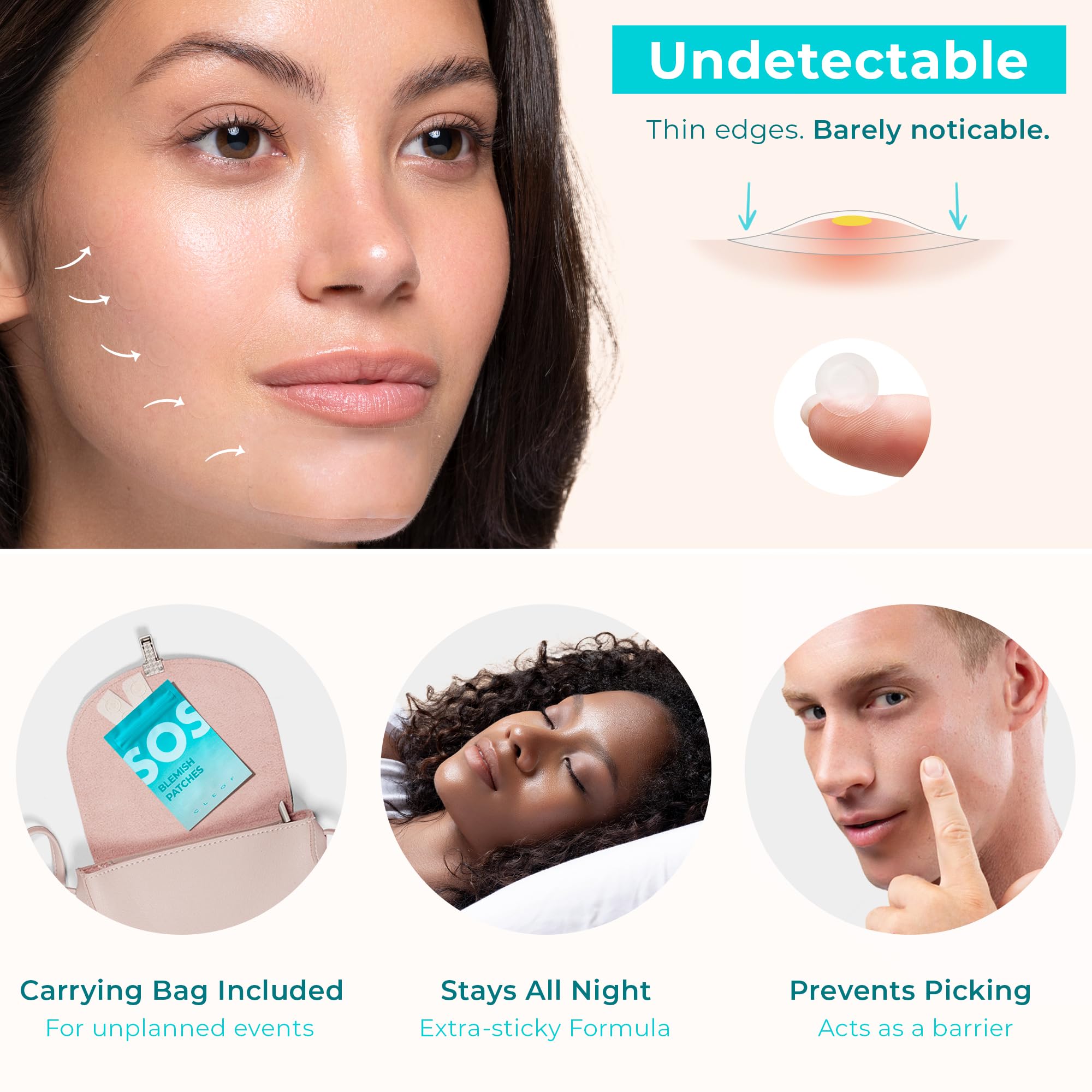 Pimple Patches for Face & Body - Overnight Treatment - Acne Patch for Zits, Dots, Bumps, Spots, Pimples, Whiteheads - Hydrocollo