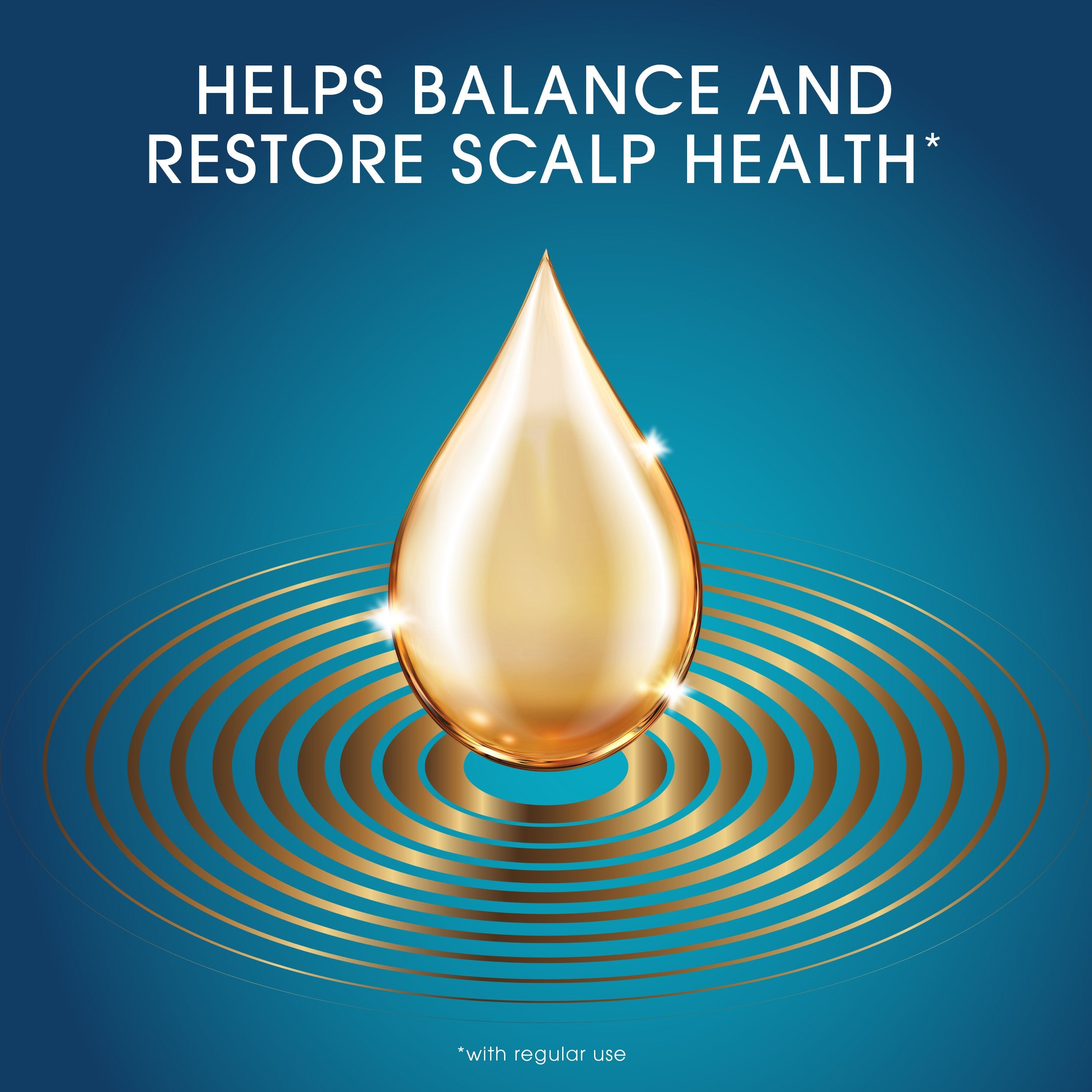 Head & Shoulders Conditioner, Moisture Renewal, Anti Dandruff Treatment and Scalp Care, Royal Oils Collection with Coconut Oil,