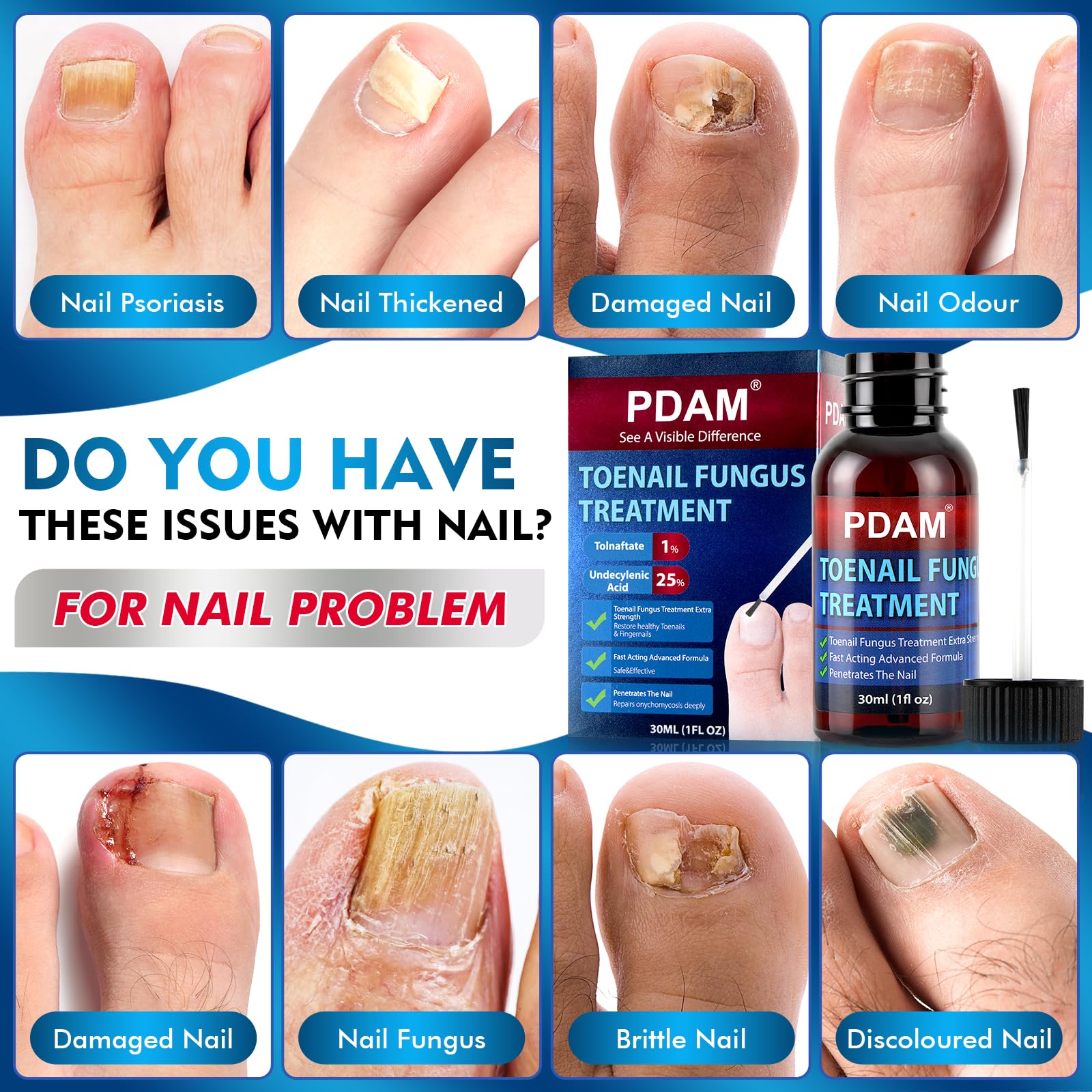Toenail Fungus Treatment Extra Strength - Toe Nail Fungus Treatments for Thick, Nail Strengthener and Growth, Nail Fungus Treatm