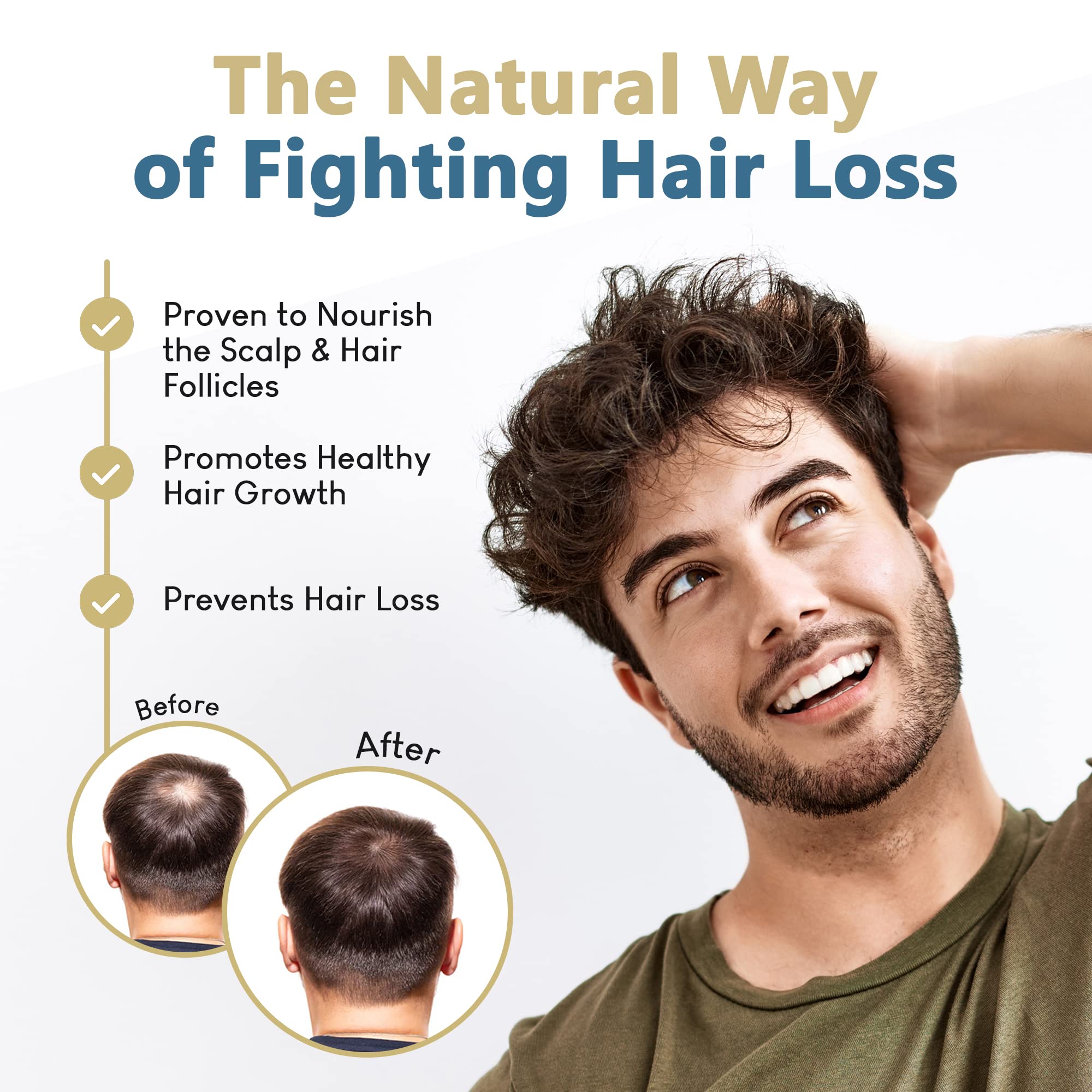 Hairmetto Topical Saw Palmetto And Pumpkin Seed Oil Extract For Hair Loss, Strengthens Hair Roots, Soothes Dry Scalp, With Rosem