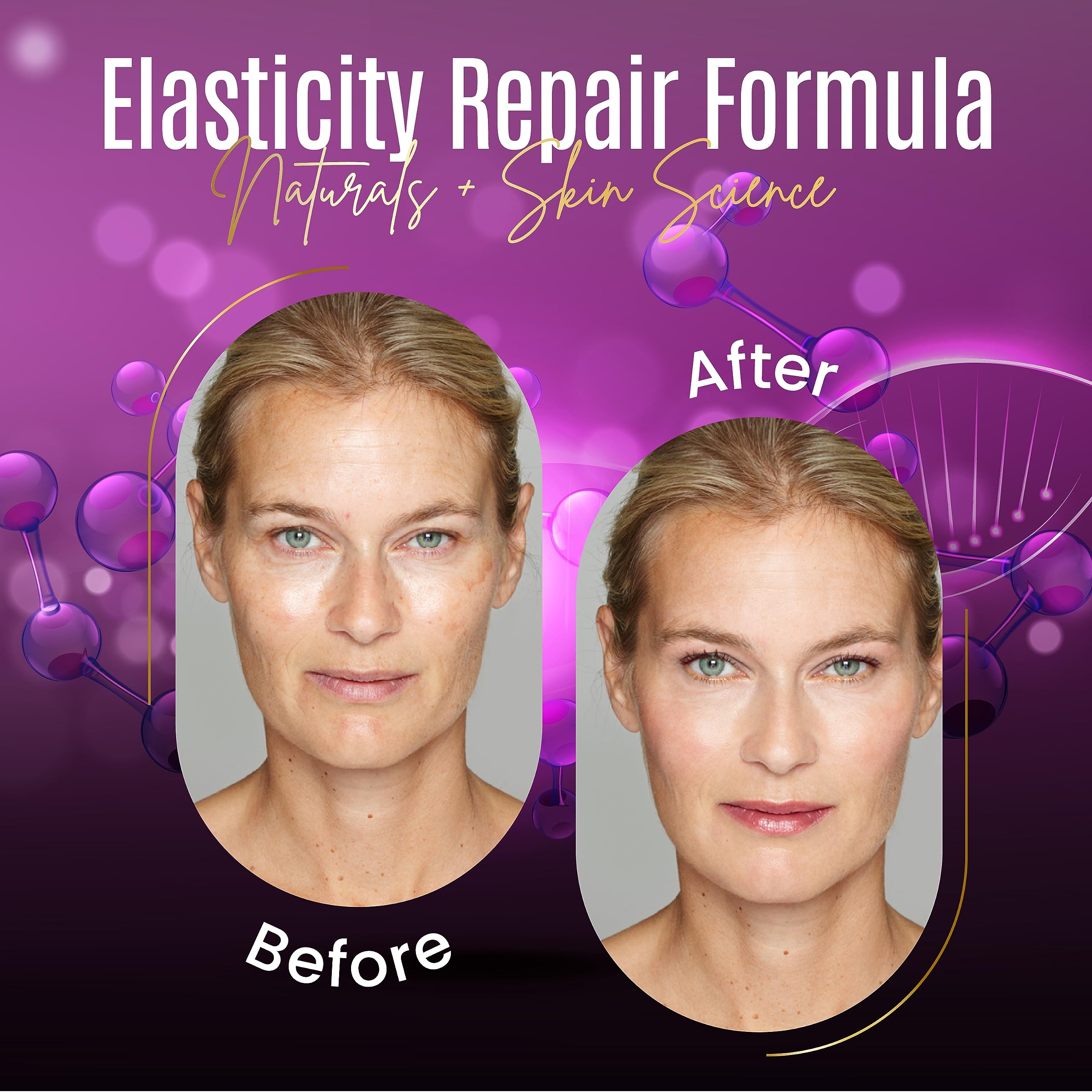 DERMAXGEN Elasticity Repair Serum, MATRIXYL 3000 - PURE ORGANIC Powerful Triple Combination Serum/Anti-Aging, Facial AGED Wrinkl