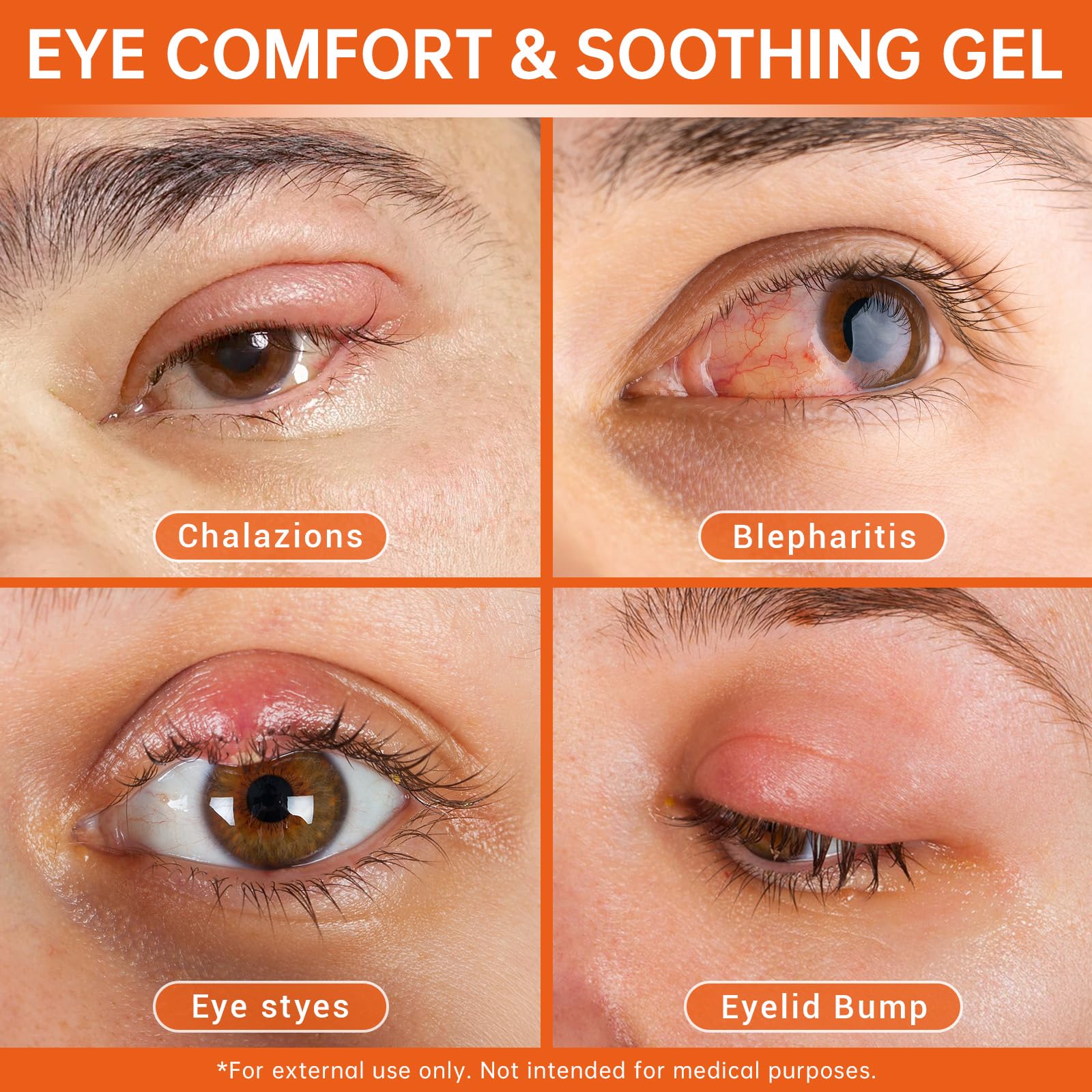 Stye Eye Relief Gel with Tea Tree Oil,Calendula & Vitamin E-Gentle Soothing Serum for Styes,Chalazion & Blepharitis,Soothing Eye