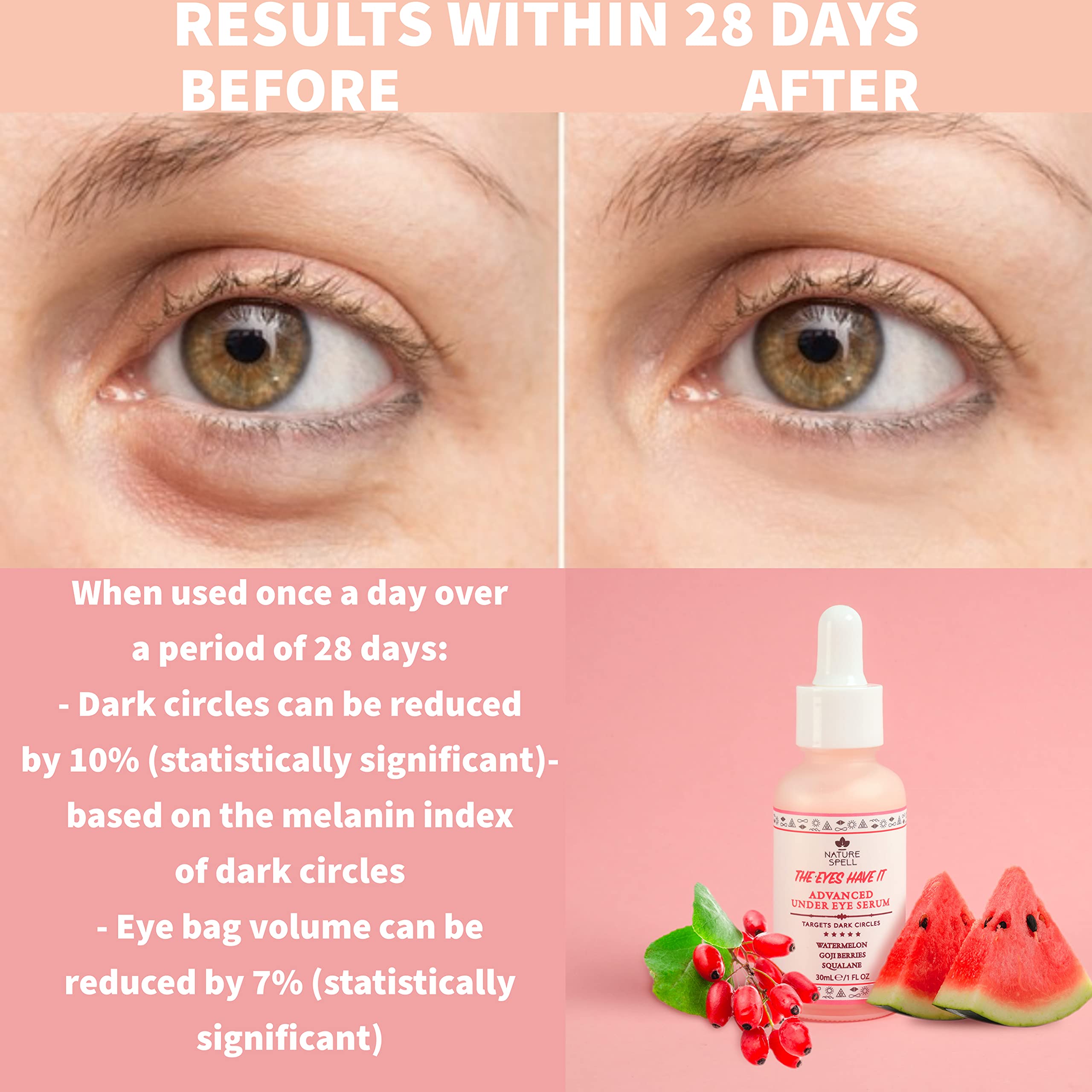 Nature Spell Advanced Under Eye Serum with Watermelon & Goji Berries 1 Fl Oz- Targets Dark Circles, Puffiness & Eyebags - Anti W