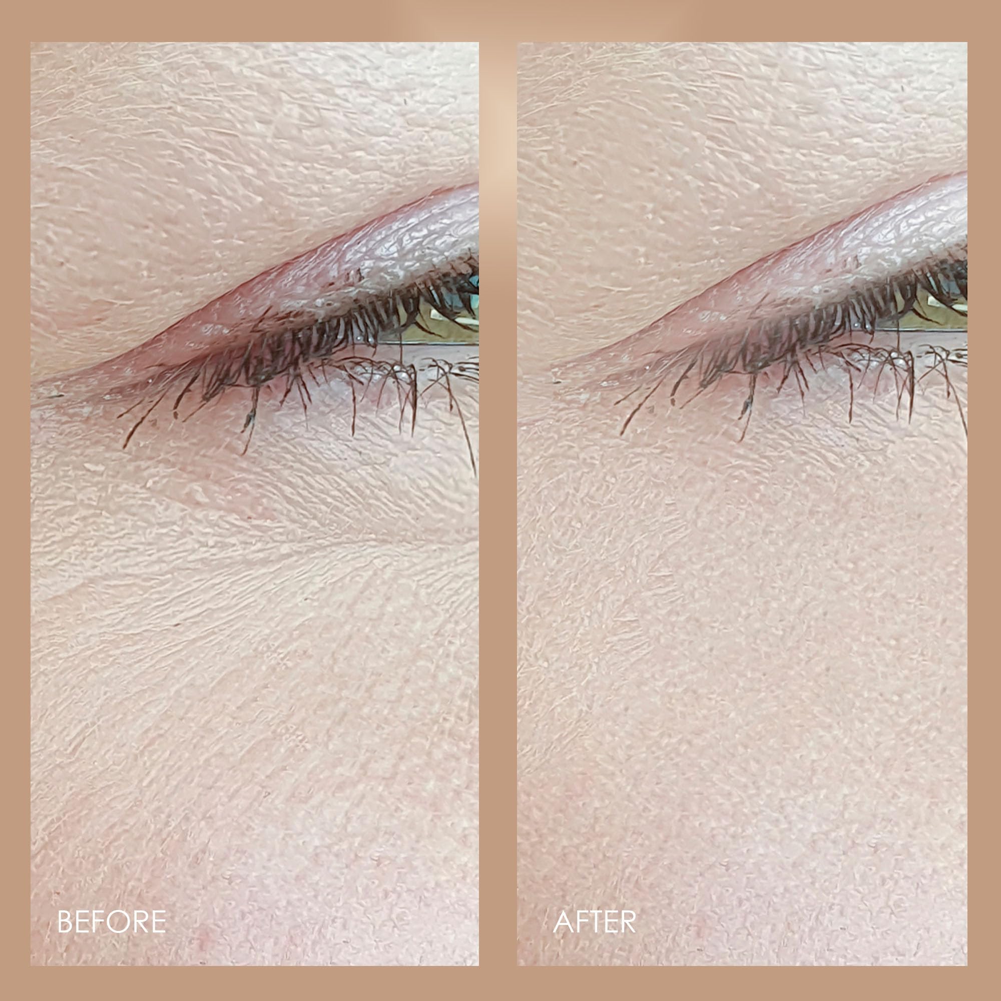 LumaGlow Red & Blue LED Light Therapy by Project E Beauty | Anti-Aging & Anti-Acne | Fine Lines & Wrinkles Scars | FDA-Cleared H