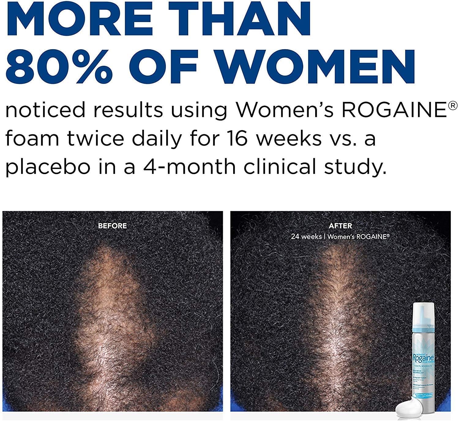 Rogaine 5% Minoxidil Foam for Women, Hair Loss Treatment, Unscented, 2.11 oz, Regrow Fuller Thicker Hair, 2-Month Supply