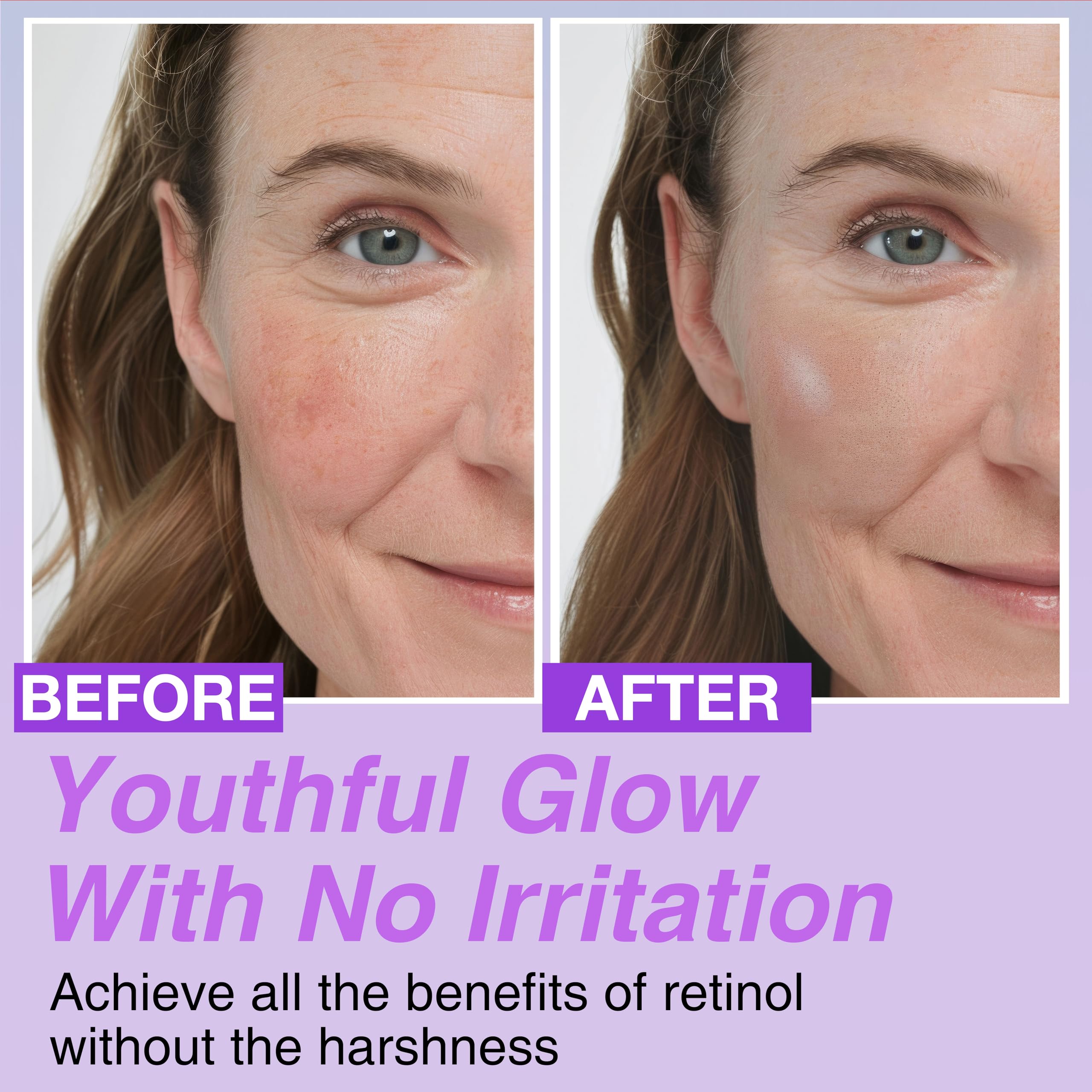 CELDYQUE Korean Bakuchiol Concentrate Serum - 30,000 ppm Retinol Alternative for Anti-Aging - 1.01 Fl Oz - Vegan & Cruelty-Free