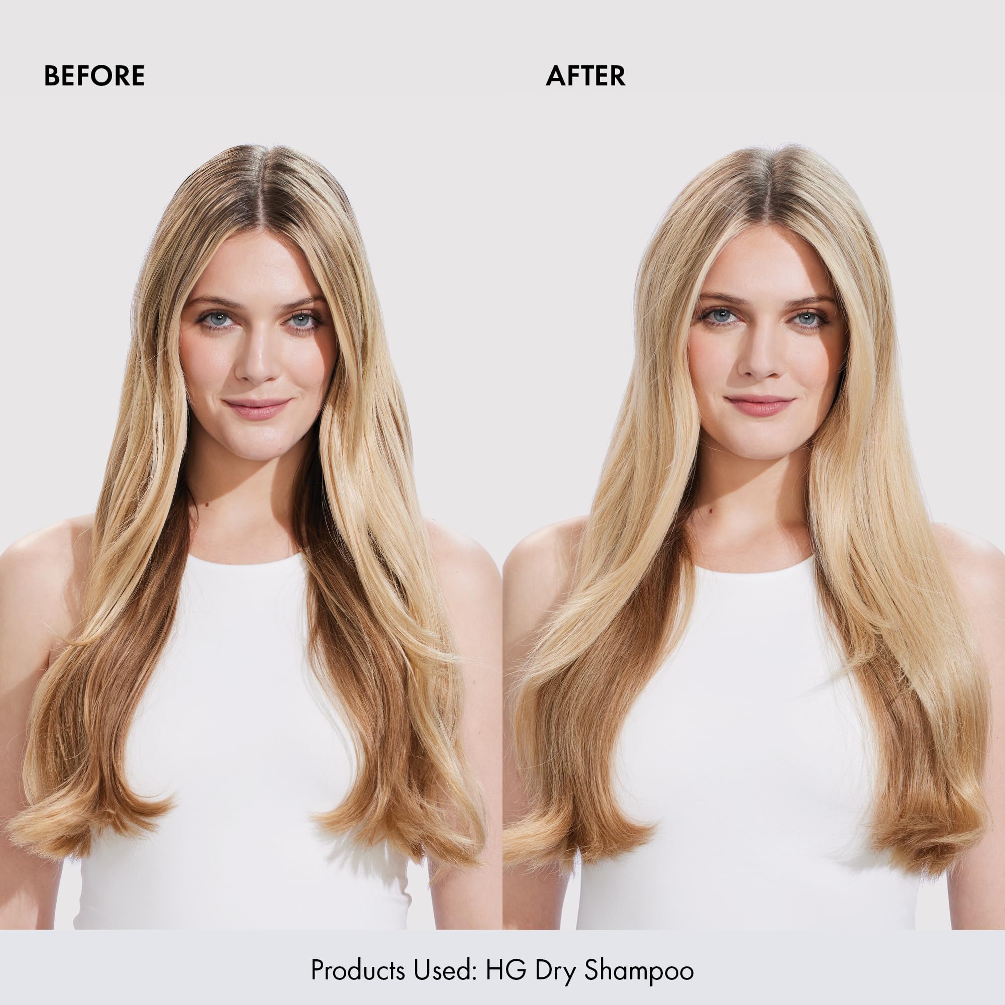 BONDIBOOST HG Dry Shampoo Spray [3.95 oz], Instantly Refresh + Protects & Strengthens Hair, Infused with Rosemary Oil, Works for