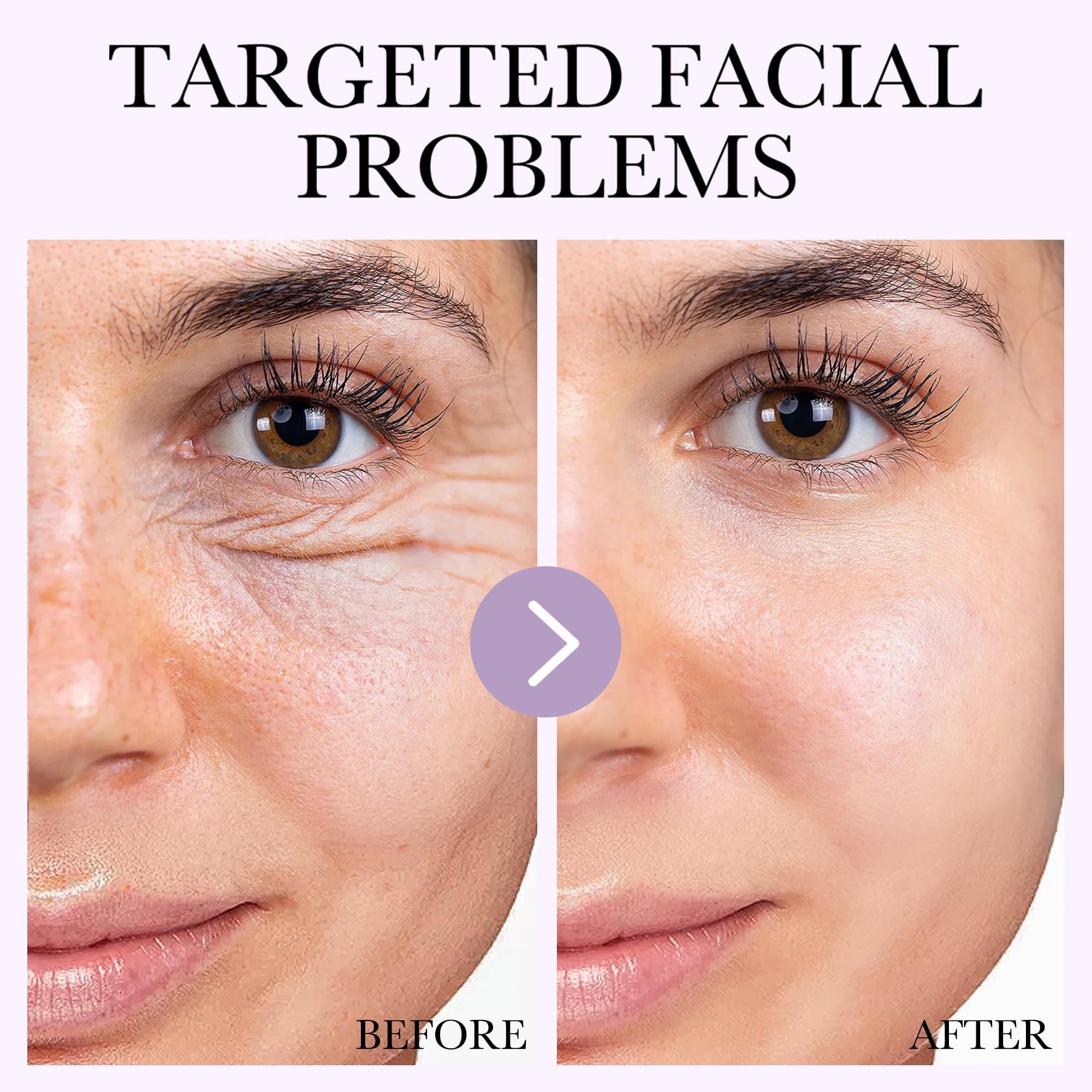 Deep Bio-Collagen Real Mask 34g*6ea, Facial Hydrogel Masks with Low Molecular Weight Collagen, Hydrating Overnight Mask for Mois