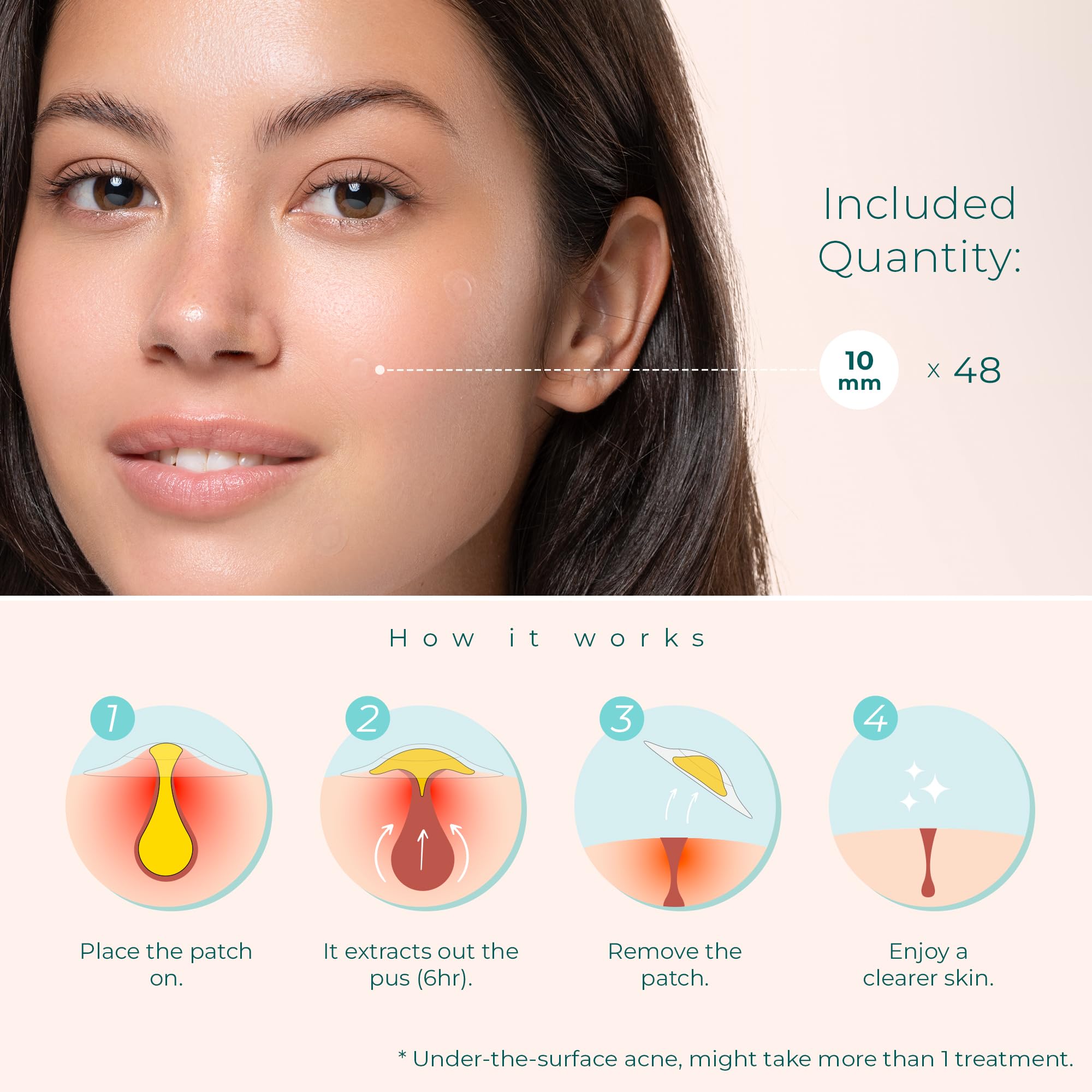 CLEOF Pimple Patches for Face & Body - Overnight Treatment - Acne Patch for Zits, Dots, Bumps, Spots, Pimples, Whiteheads - Hydr